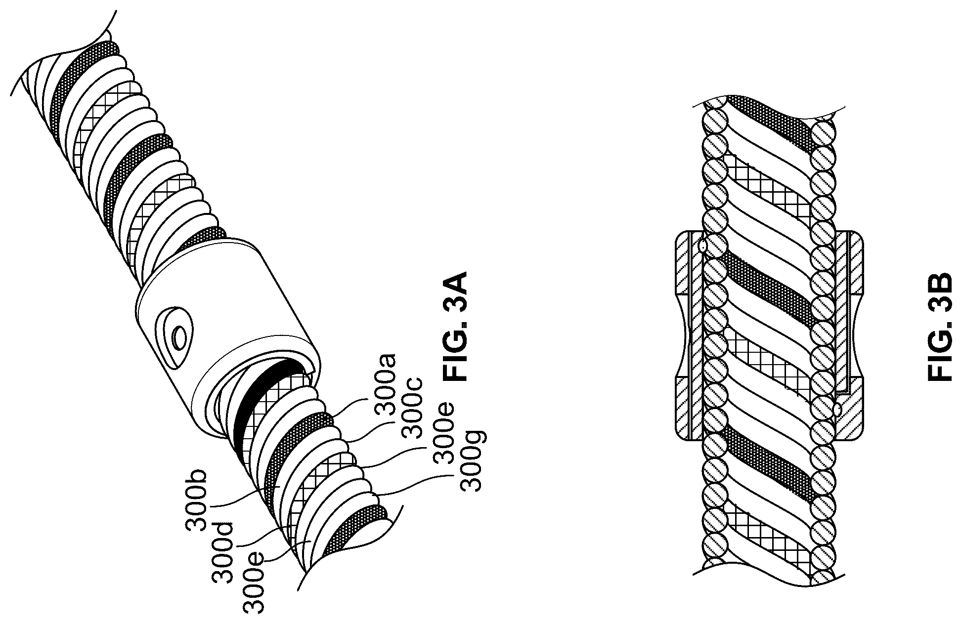 Patent US12551206 Figure 4 – Device with features for rotational atherectomy and lithotripsy