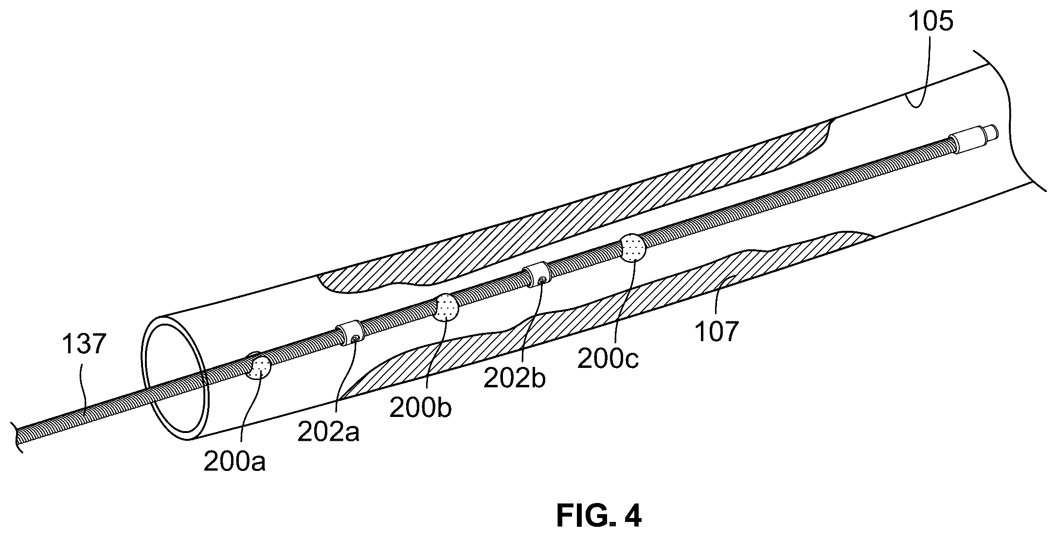 Patent US12551206 Figure 5 – Device with features for rotational atherectomy and lithotripsy
