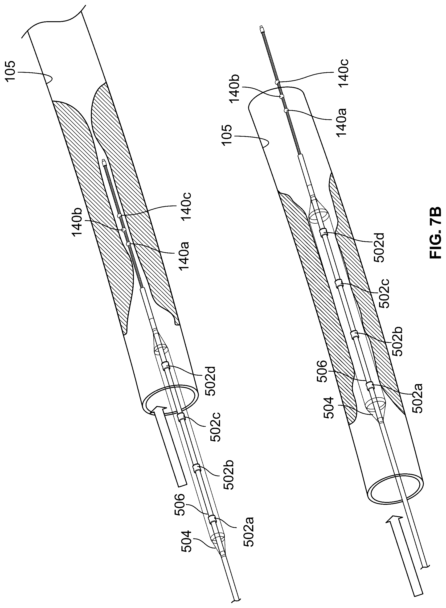 Patent US12551206 Figure 10 – Device with features for rotational atherectomy and lithotripsy
