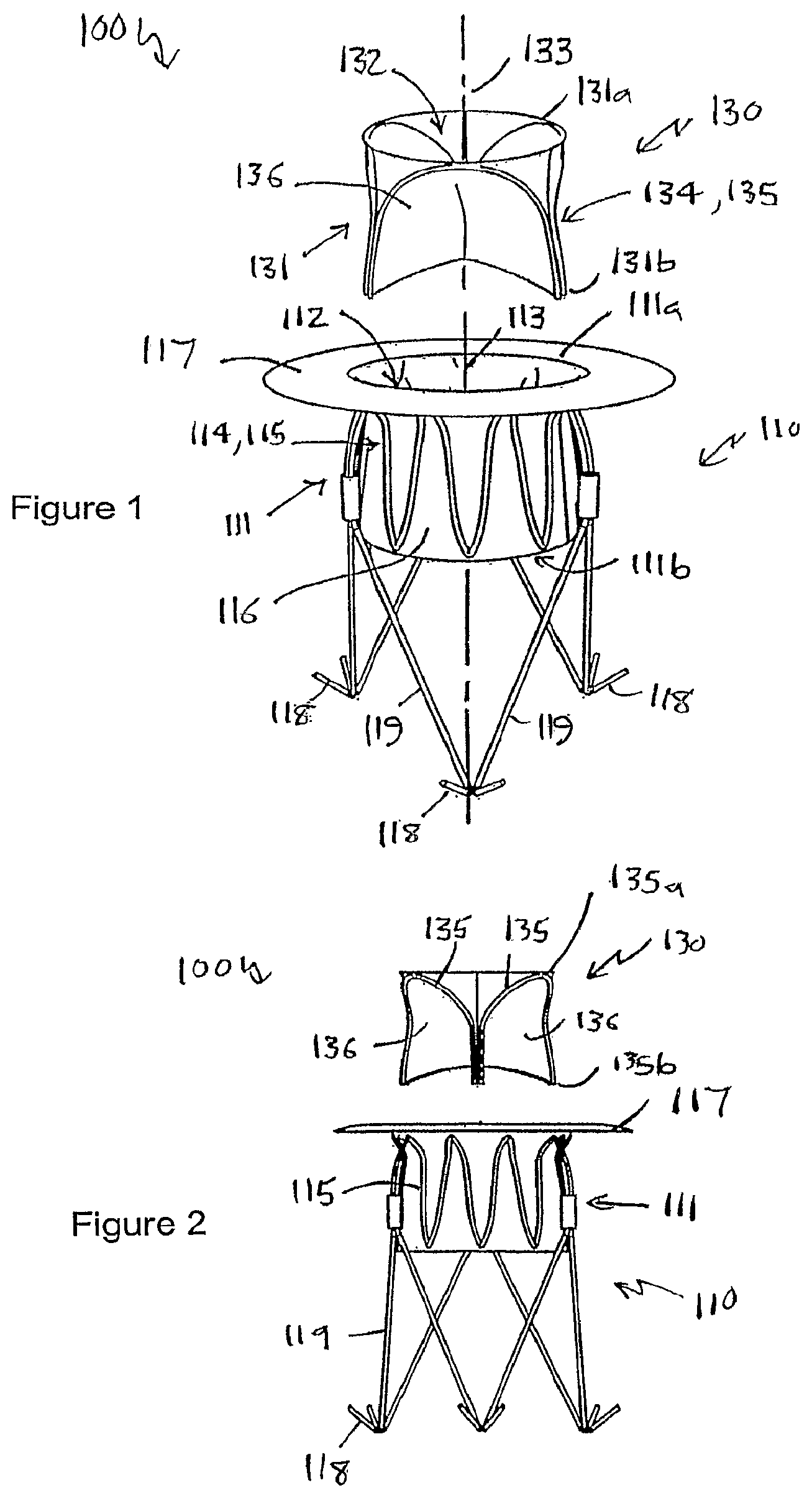Patent US12551207 Figure 1 – Heart valve prosthesis and method