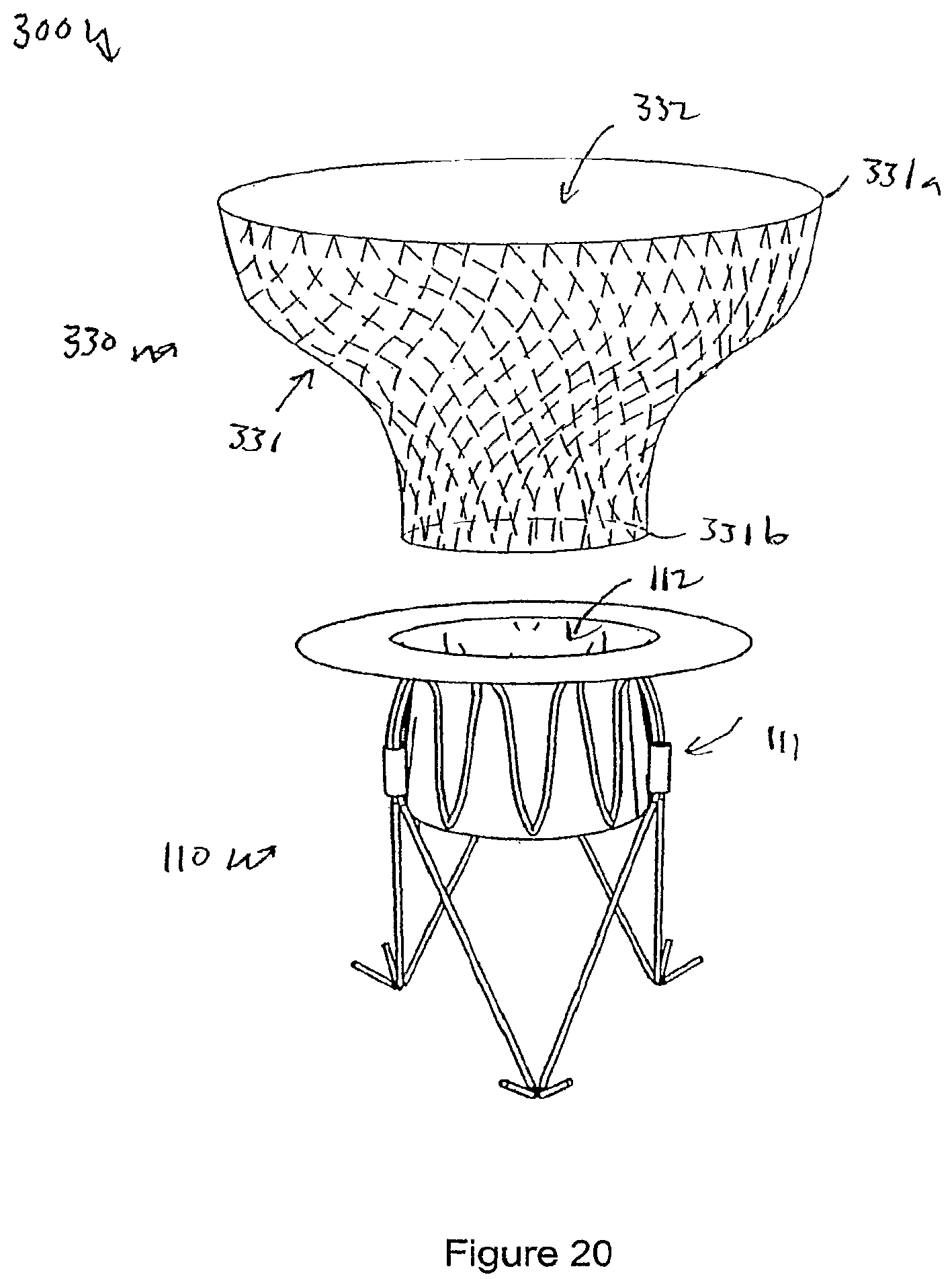 Patent US12551207 Figure 17 – Heart valve prosthesis and method