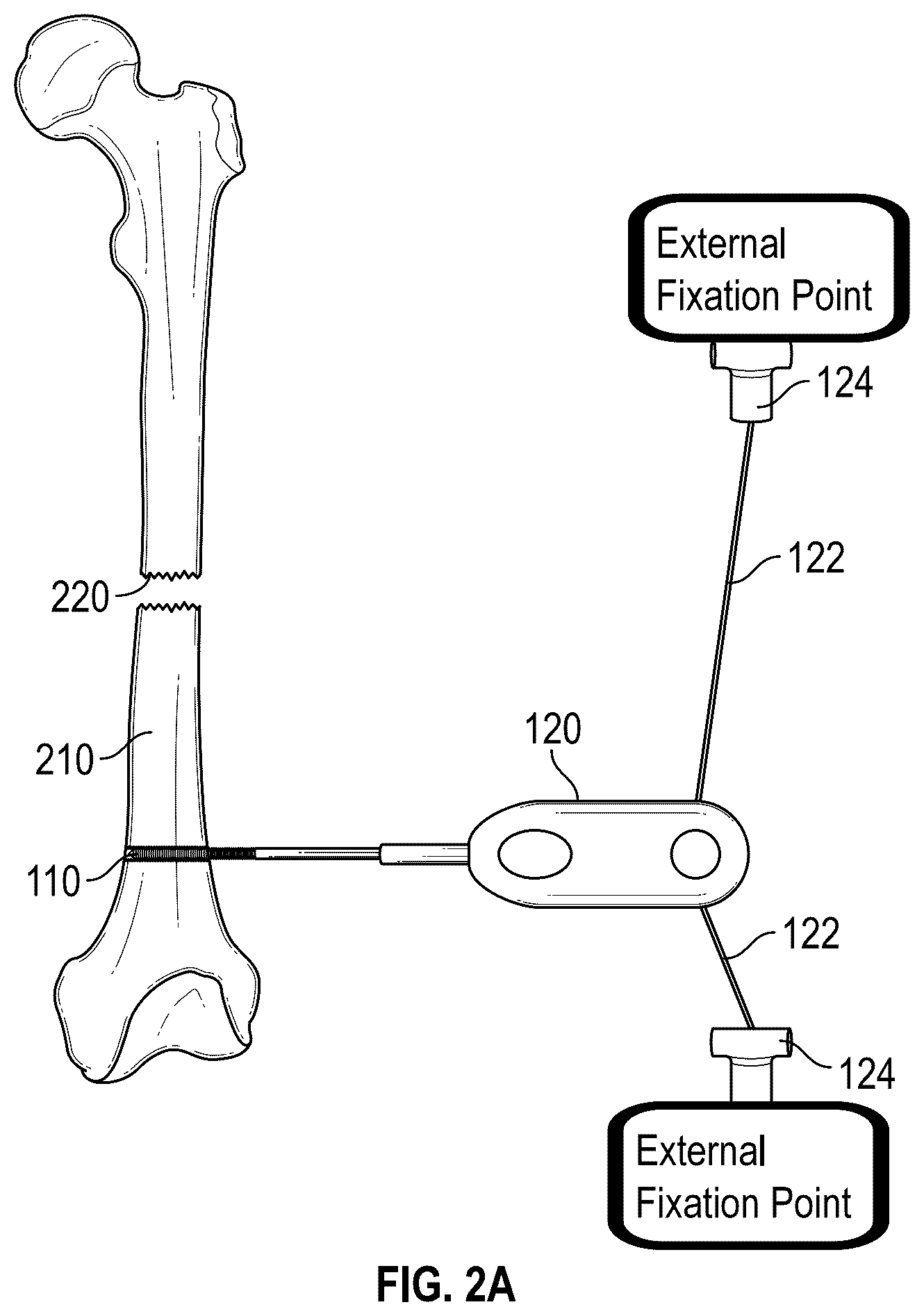 Patent US12551208 Figure 2 – Self-retaining bone holding devices and methods