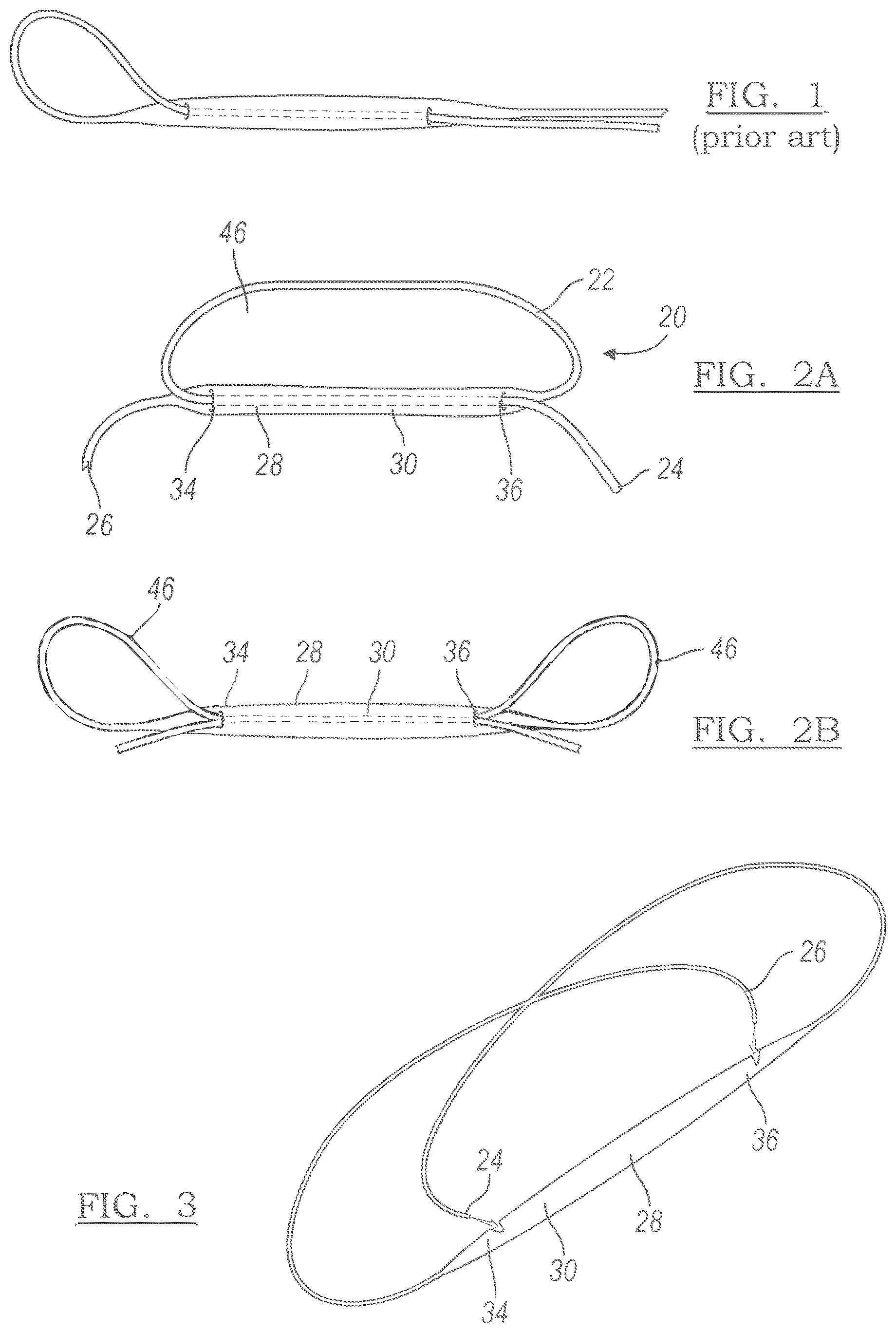 Patent US12551209 — Method and apparatus for coupling soft tissue to a bone — Figure 1