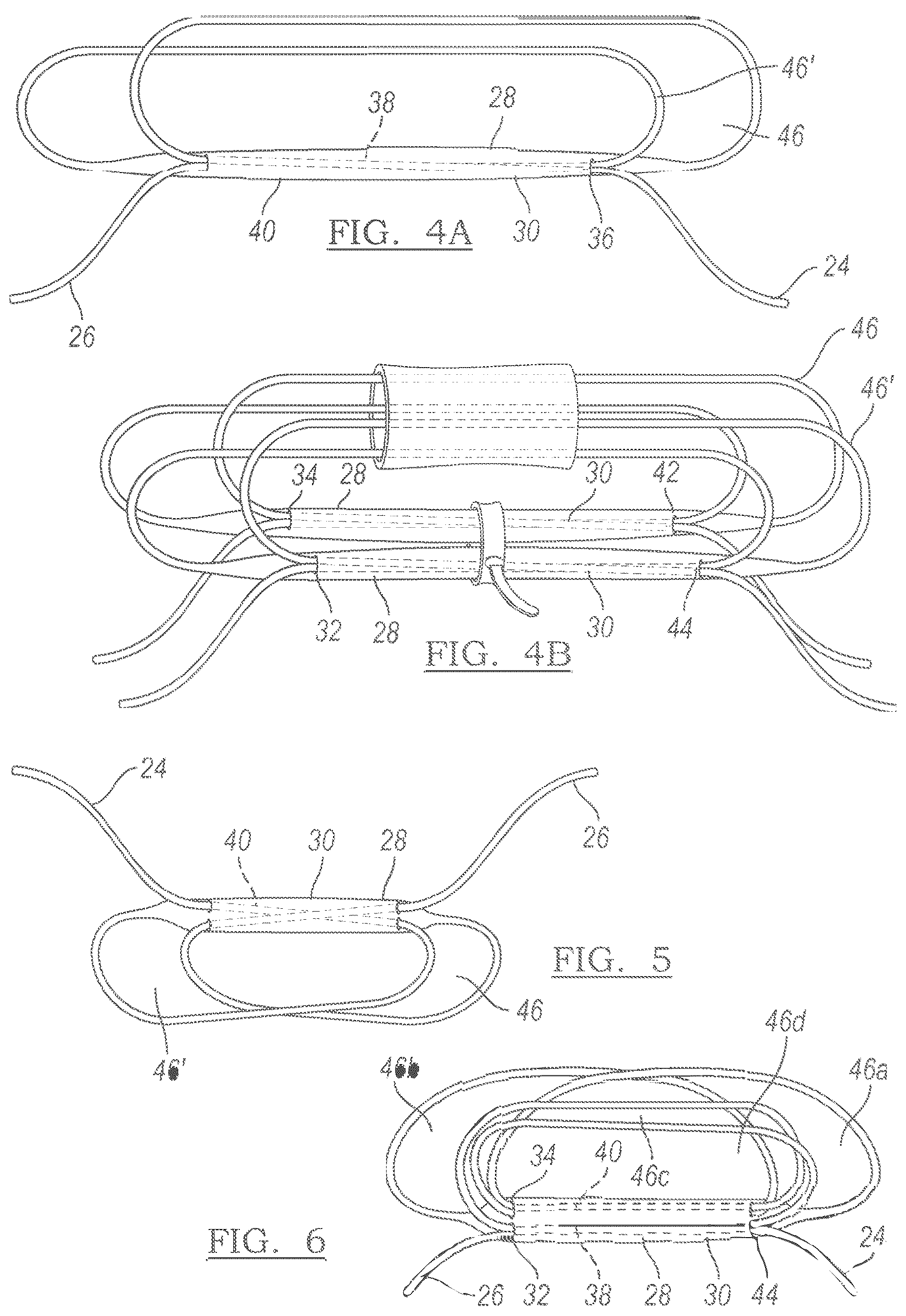Patent US12551209 Figure 2 – Method and apparatus for coupling soft tissue to a bone
