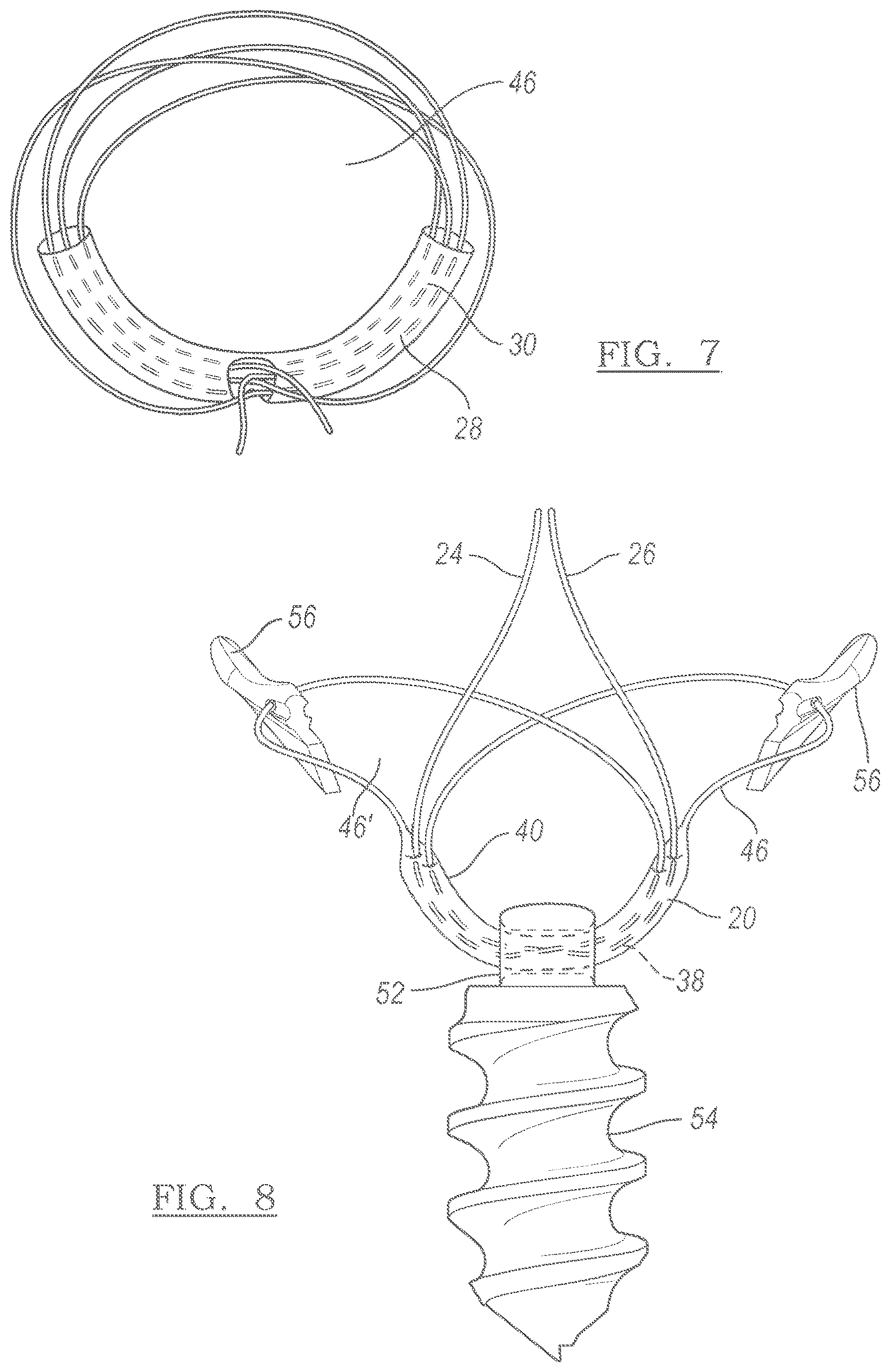 Patent US12551209 Figure 3 – Method and apparatus for coupling soft tissue to a bone