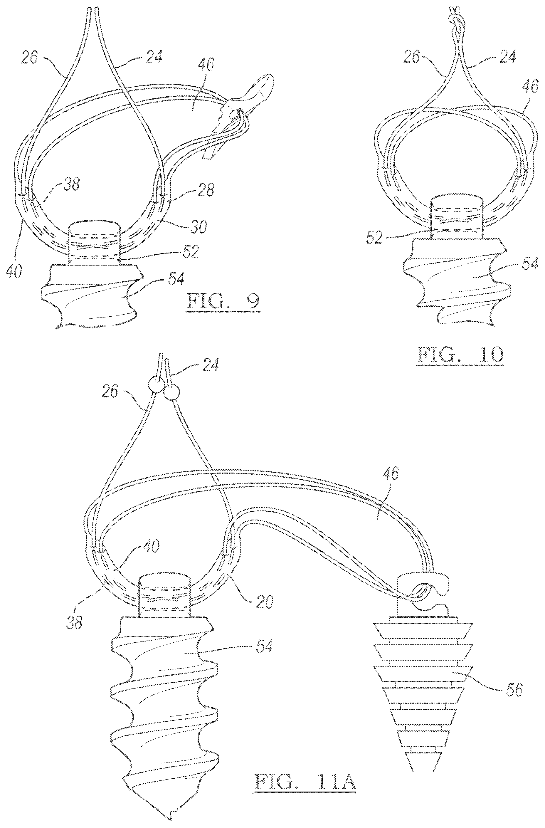 Patent US12551209 Figure 4 – Method and apparatus for coupling soft tissue to a bone