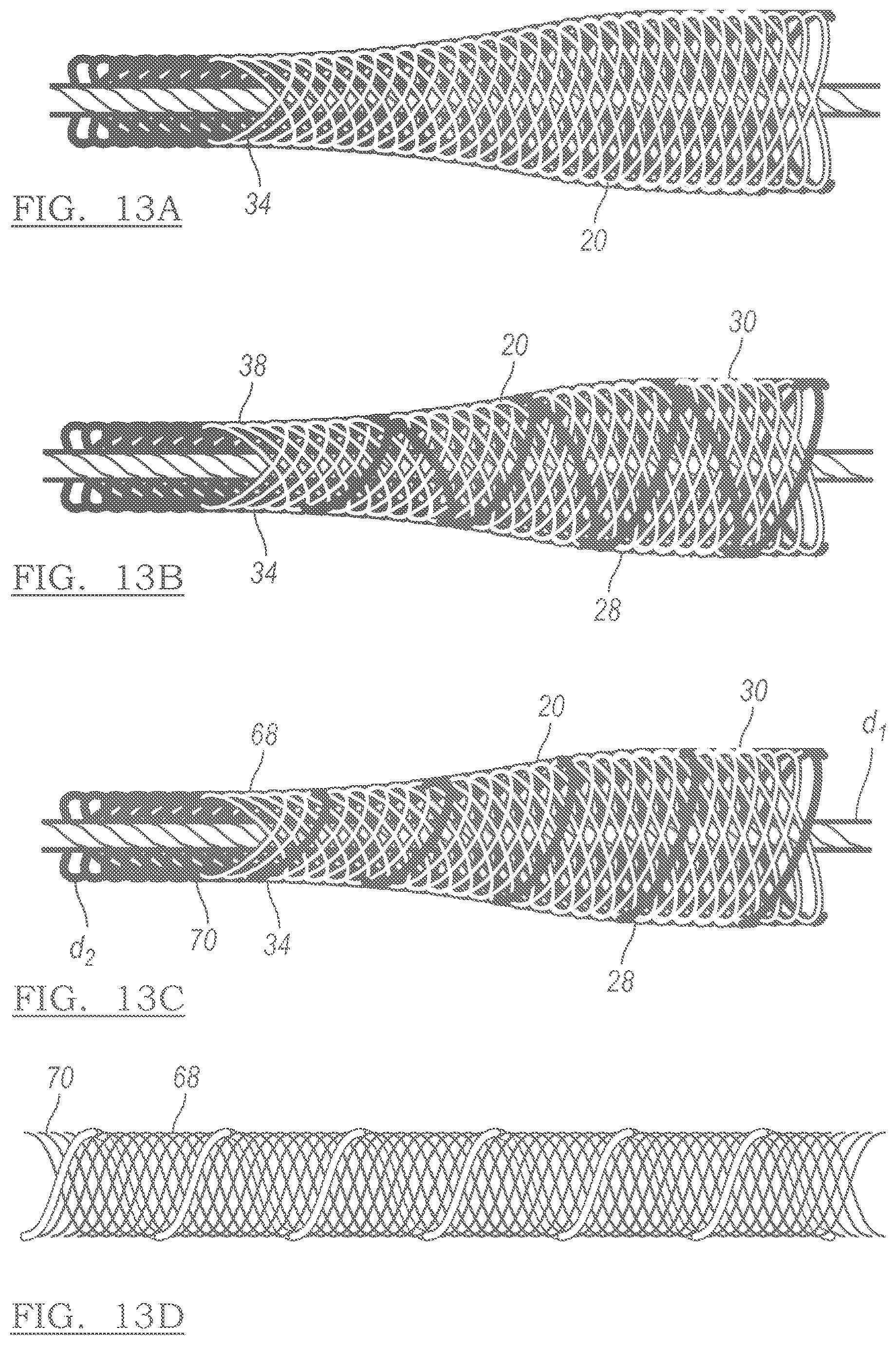 Patent US12551209 Figure 11 – Method and apparatus for coupling soft tissue to a bone