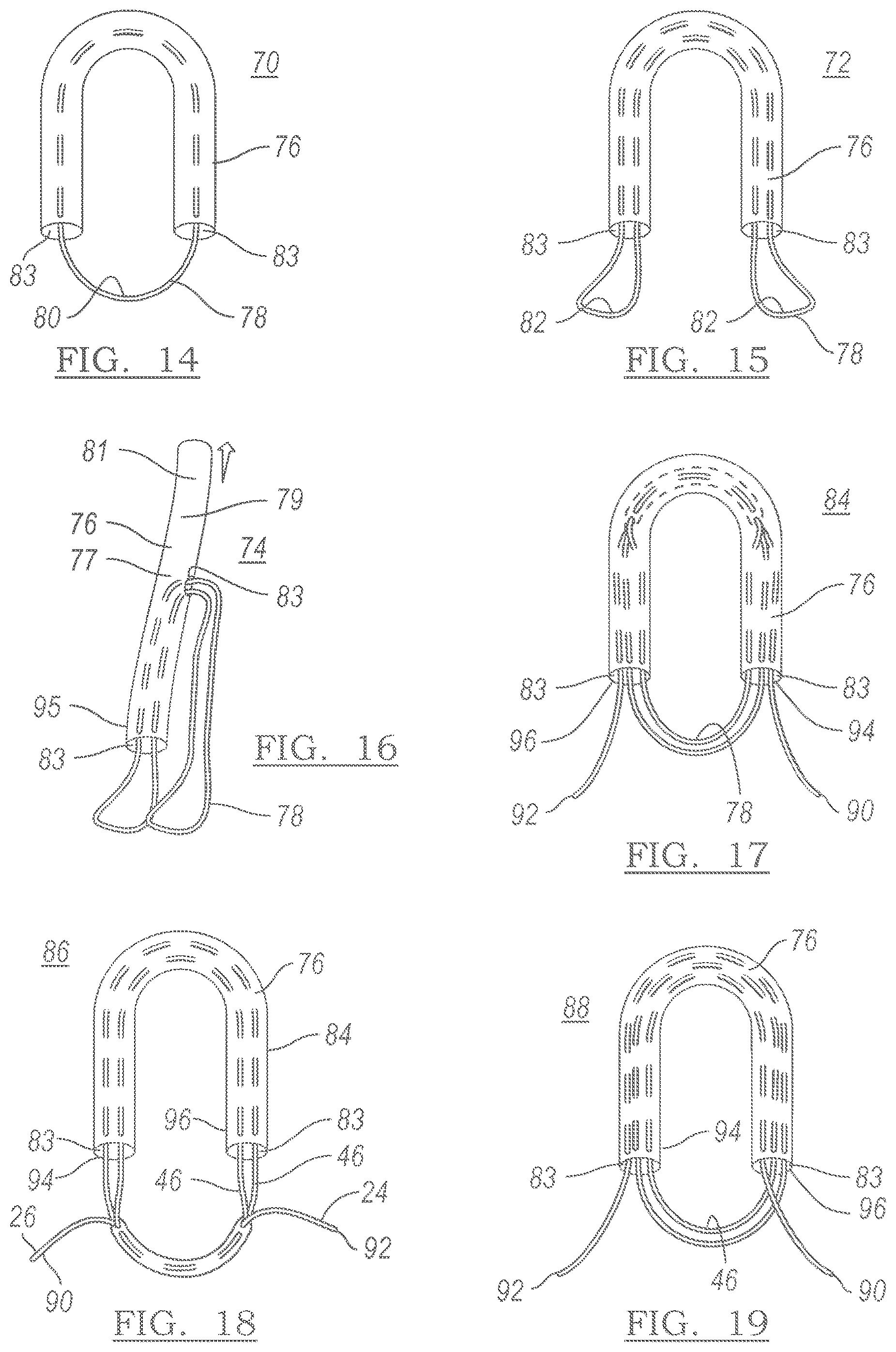 Patent US12551209 Figure 12 – Method and apparatus for coupling soft tissue to a bone