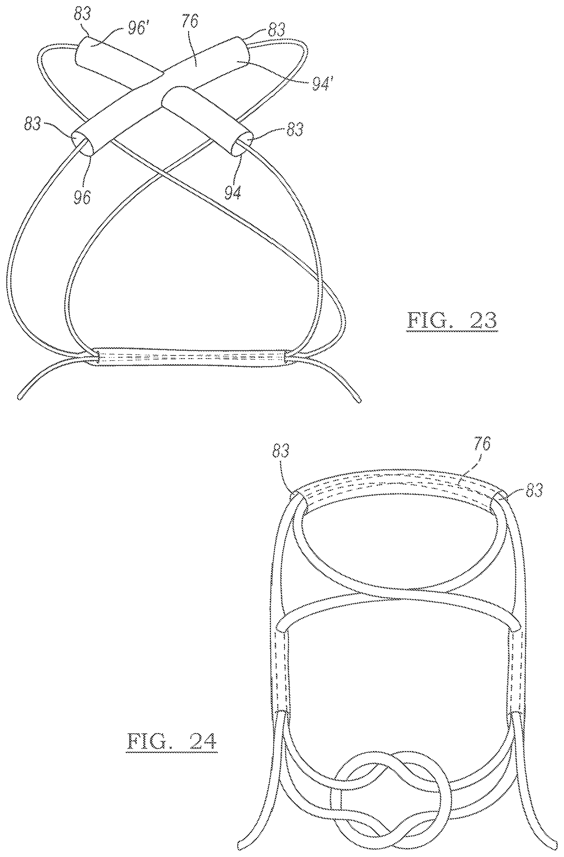 Patent US12551209 Figure 14 – Method and apparatus for coupling soft tissue to a bone