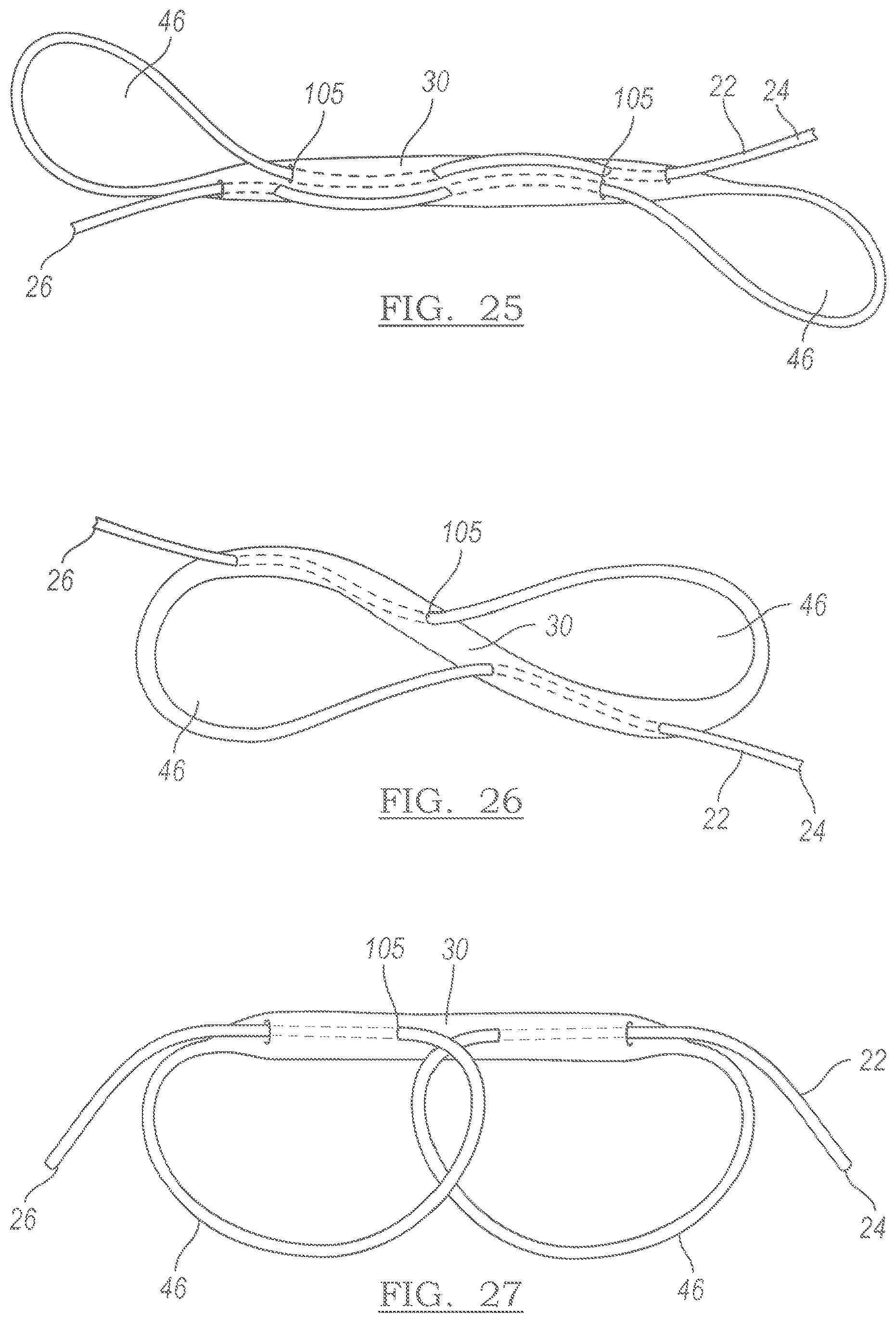 Patent US12551209 Figure 15 – Method and apparatus for coupling soft tissue to a bone