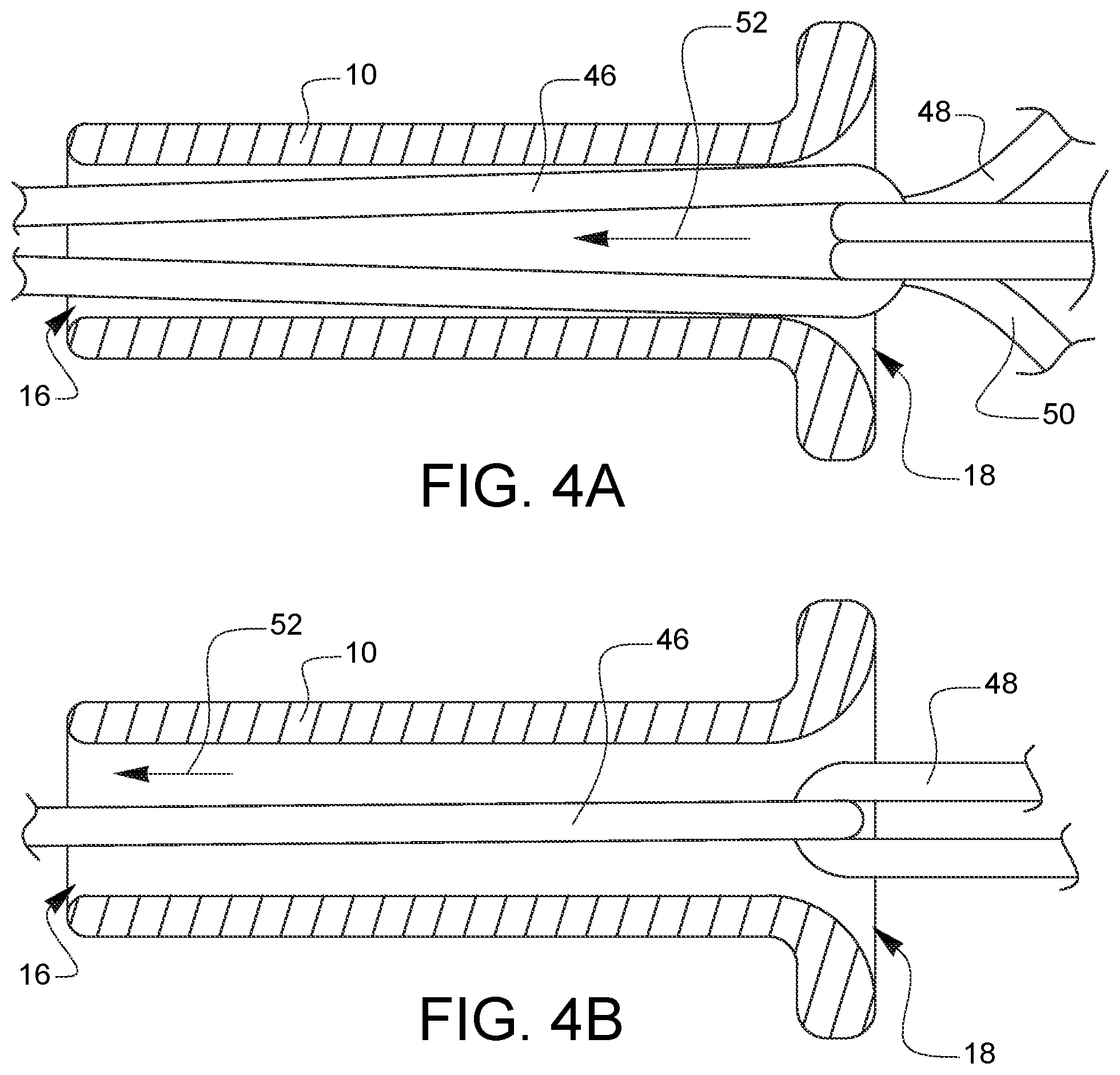 Patent US12551210 Figure 5 – Mechanical suture fastener