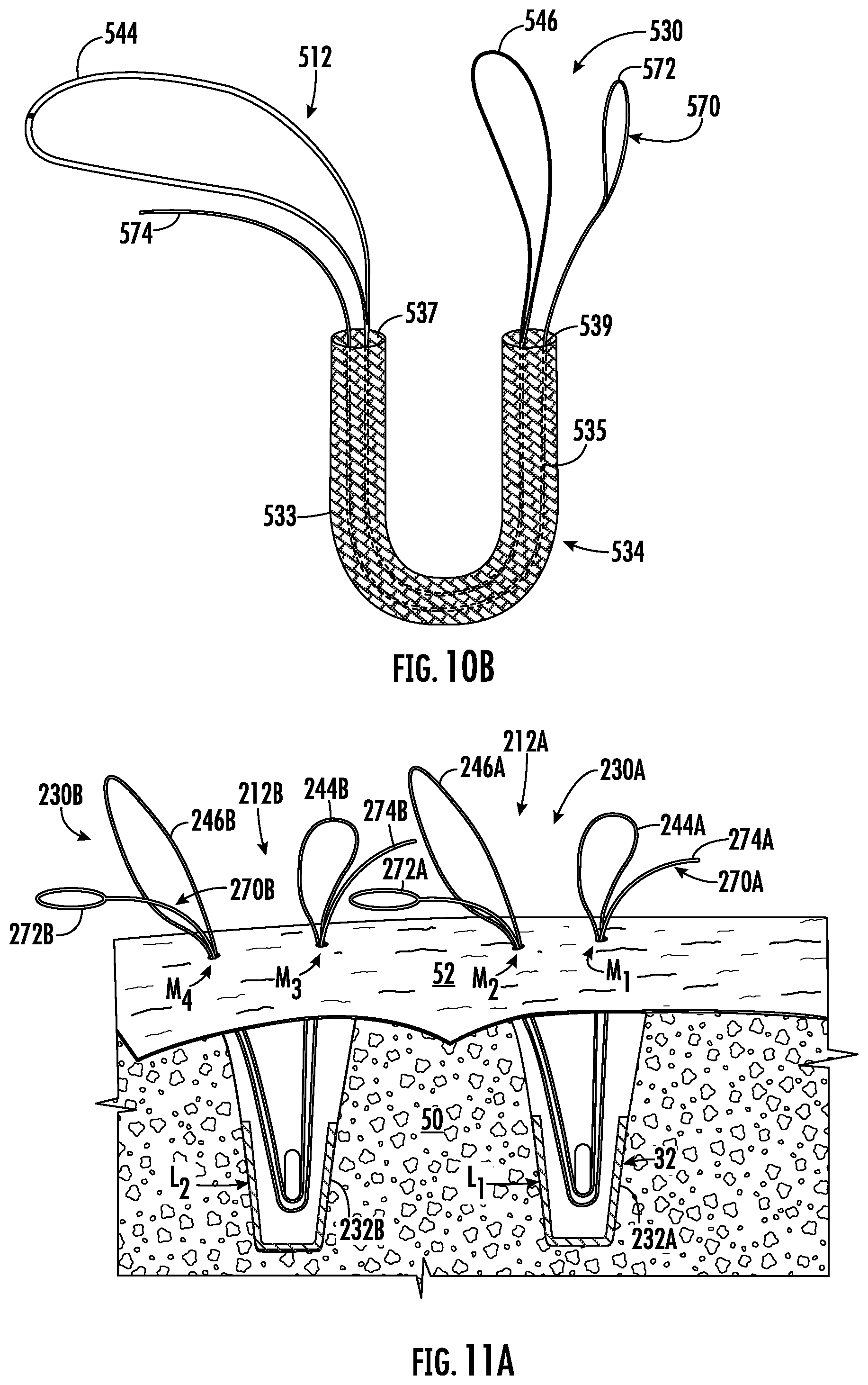 Patent US12551211 Figure 6 – Suture anchor
