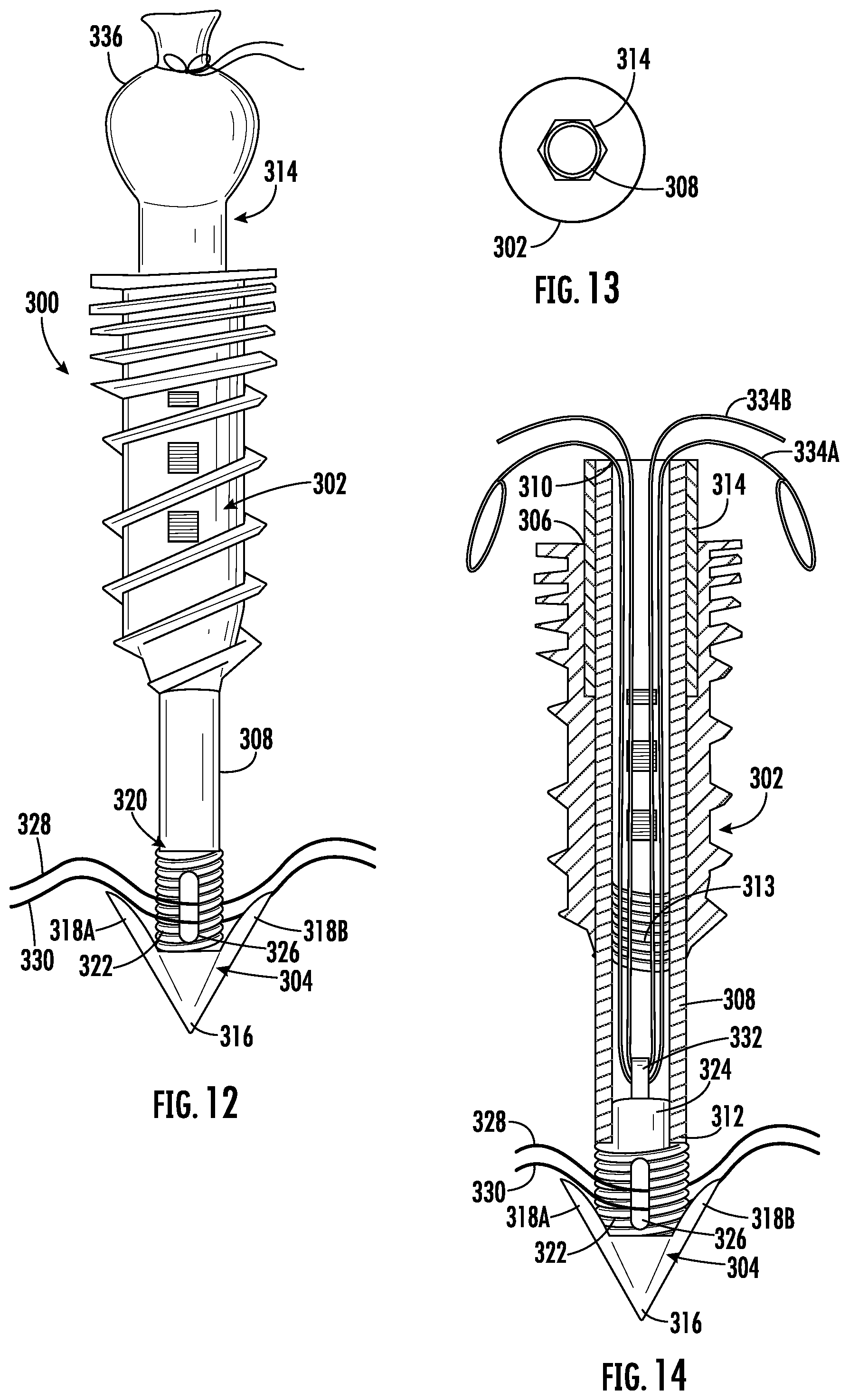 Patent US12551211 Figure 9 – Suture anchor