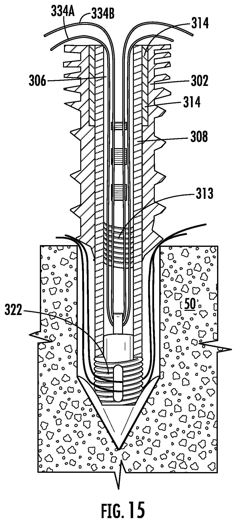 Patent US12551211 Figure 10 – Suture anchor