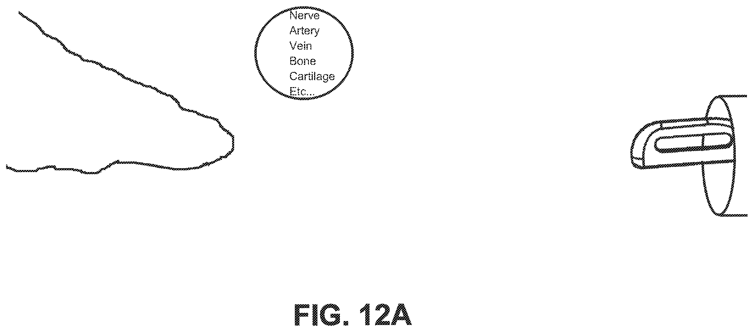 Patent US12551212 Figure 11 – Suture passer devices and methods