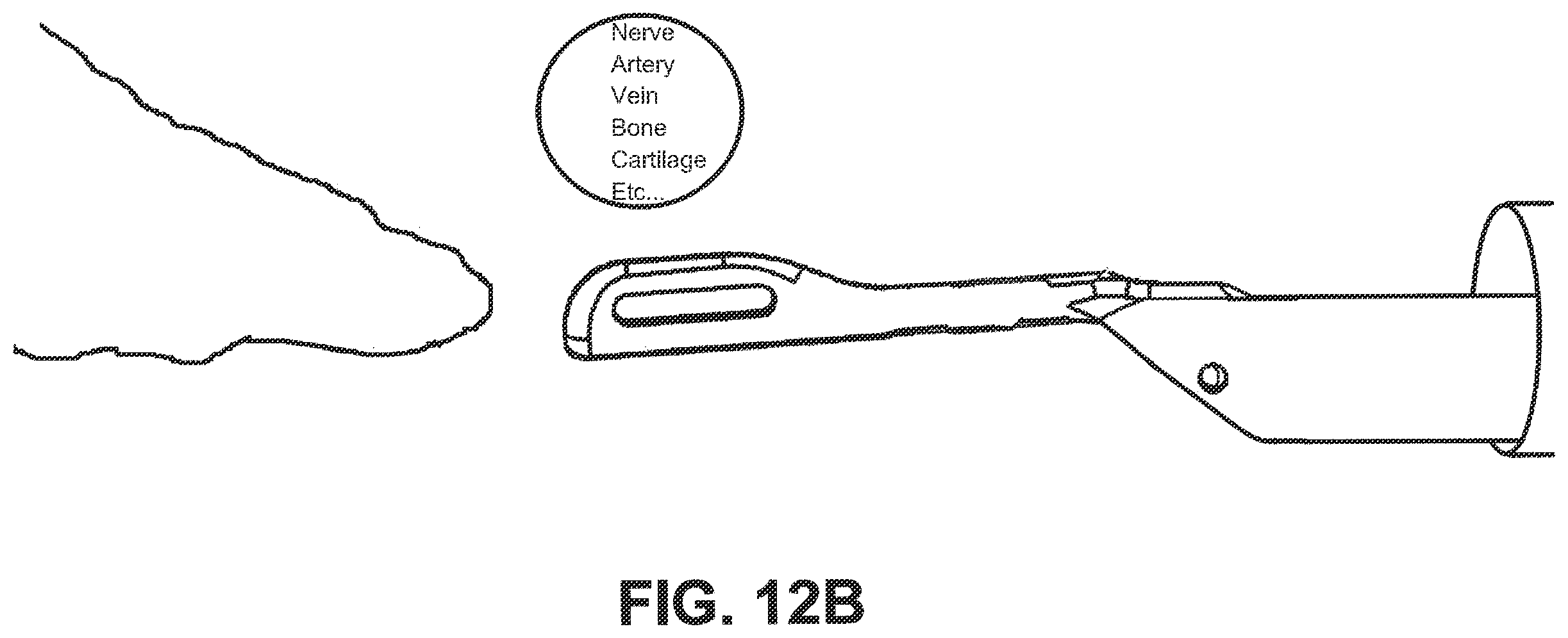 Patent US12551212 Figure 12 – Suture passer devices and methods