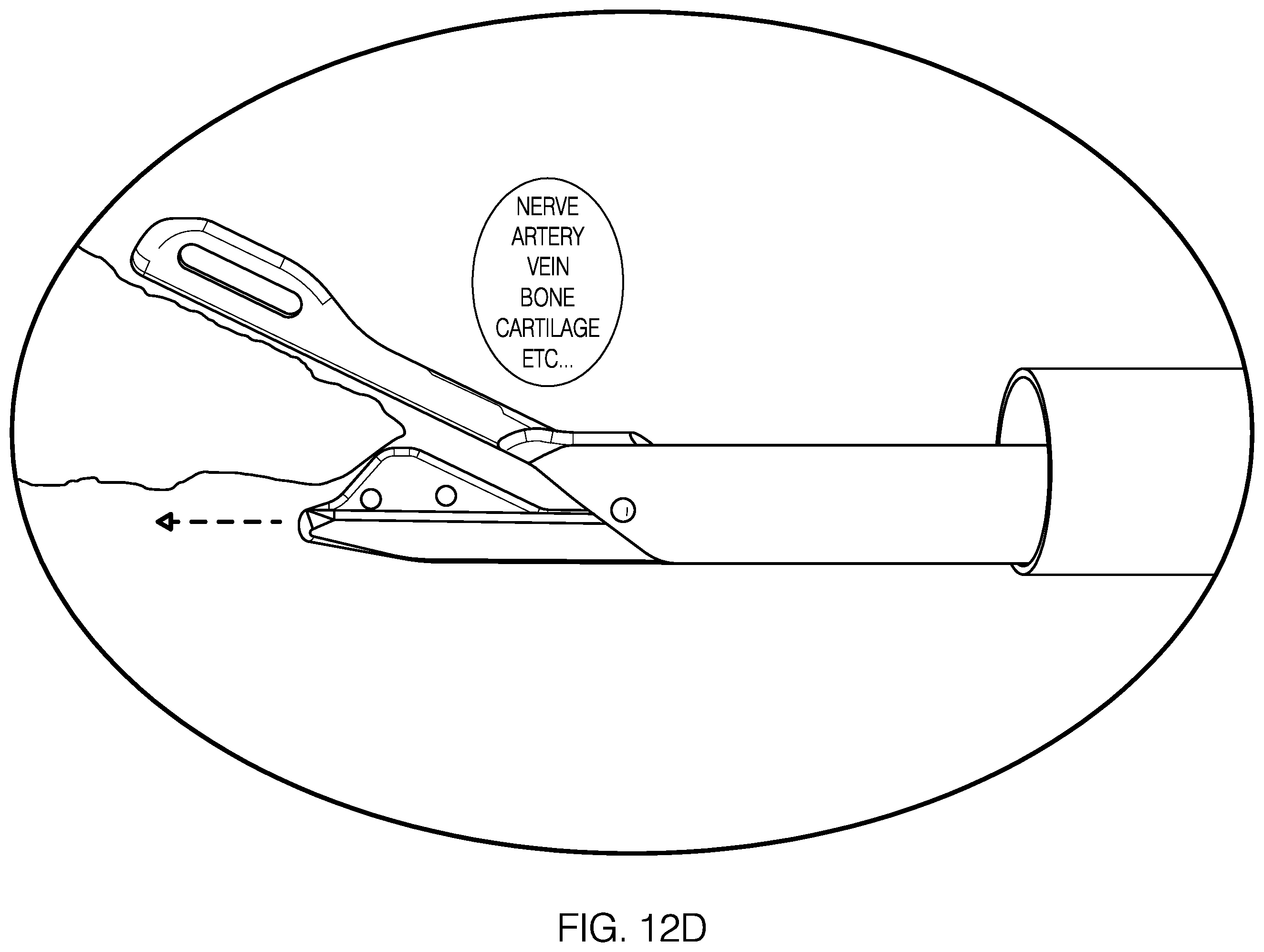 Patent US12551212 Figure 14 – Suture passer devices and methods