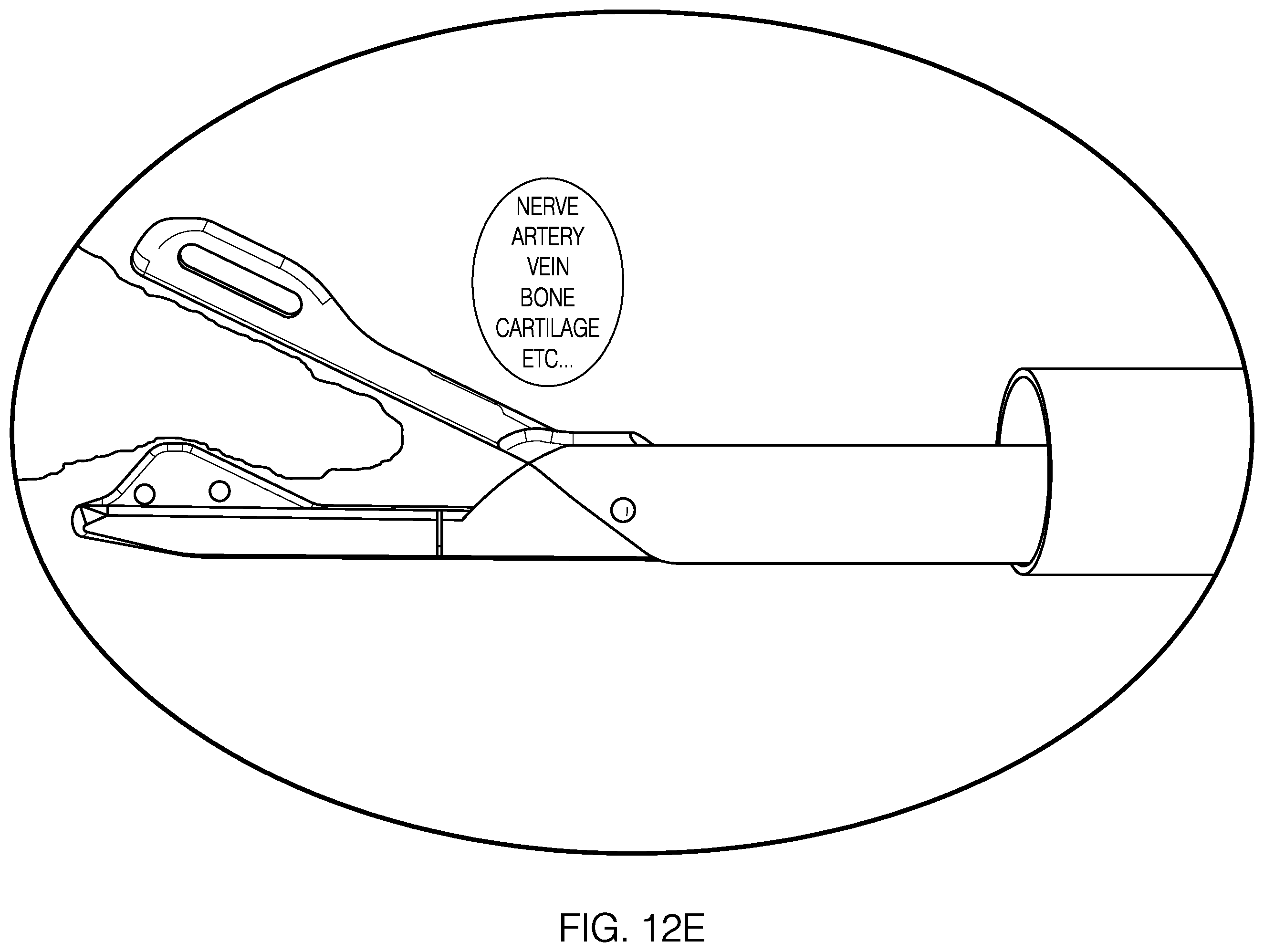 Patent US12551212 Figure 15 – Suture passer devices and methods