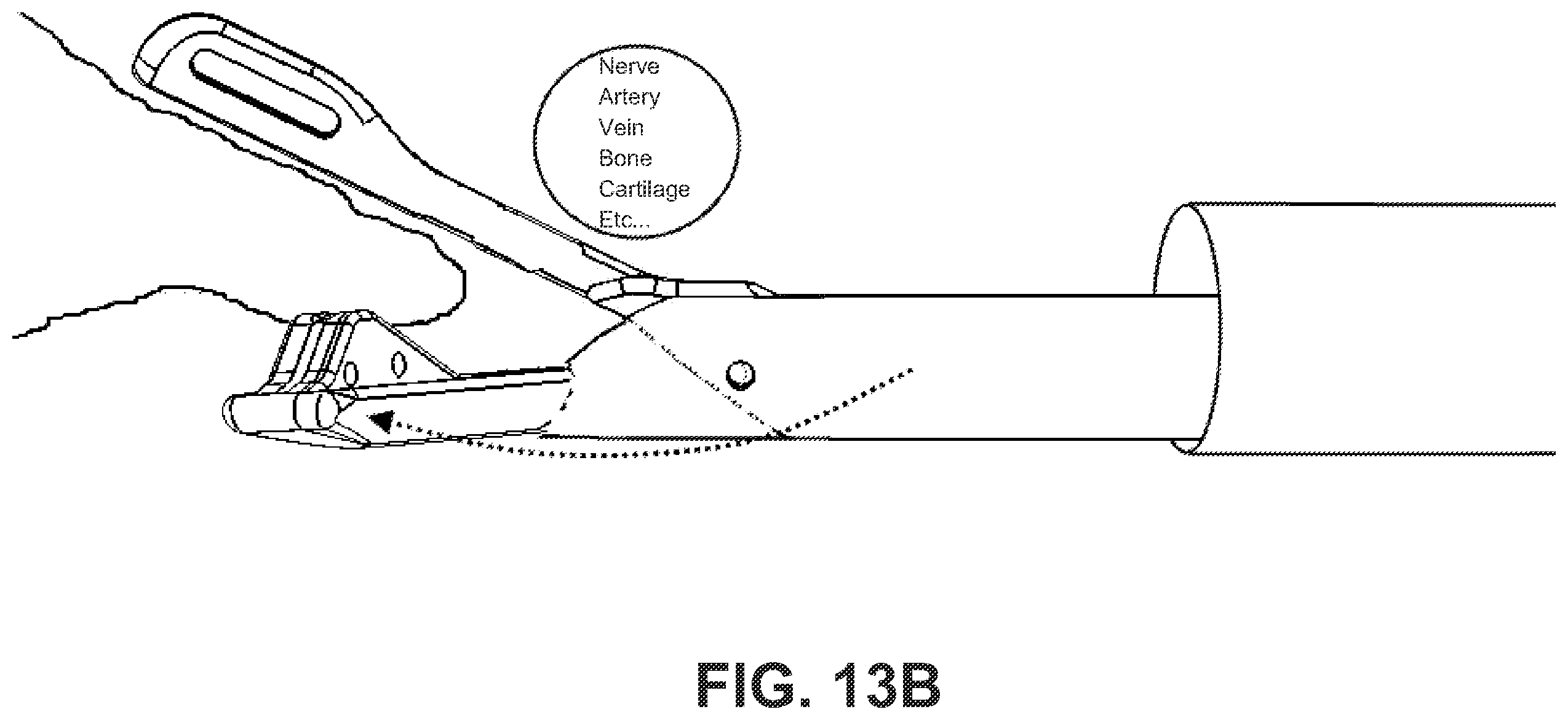 Patent US12551212 Figure 17 – Suture passer devices and methods