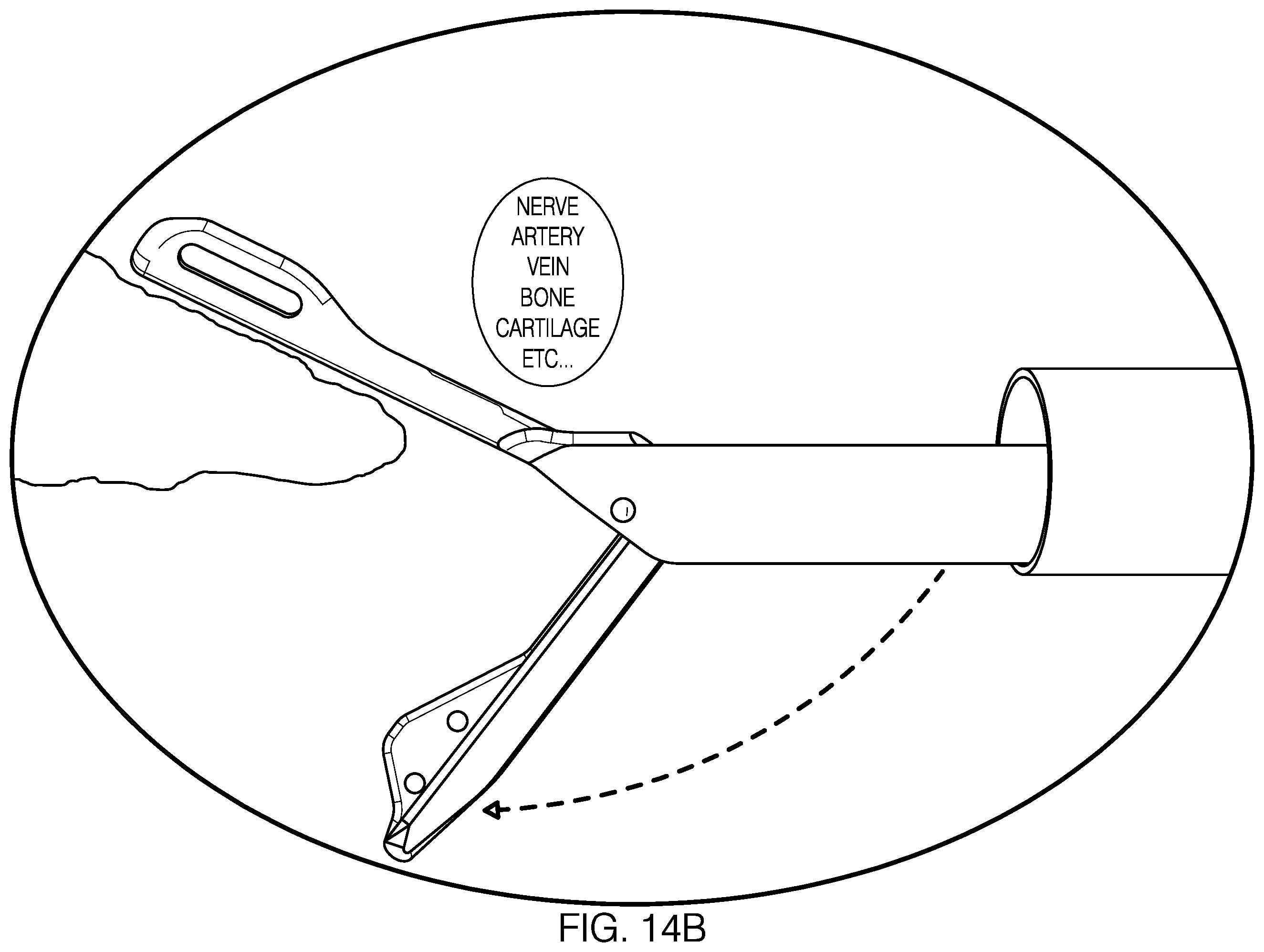 Patent US12551212 Figure 20 – Suture passer devices and methods