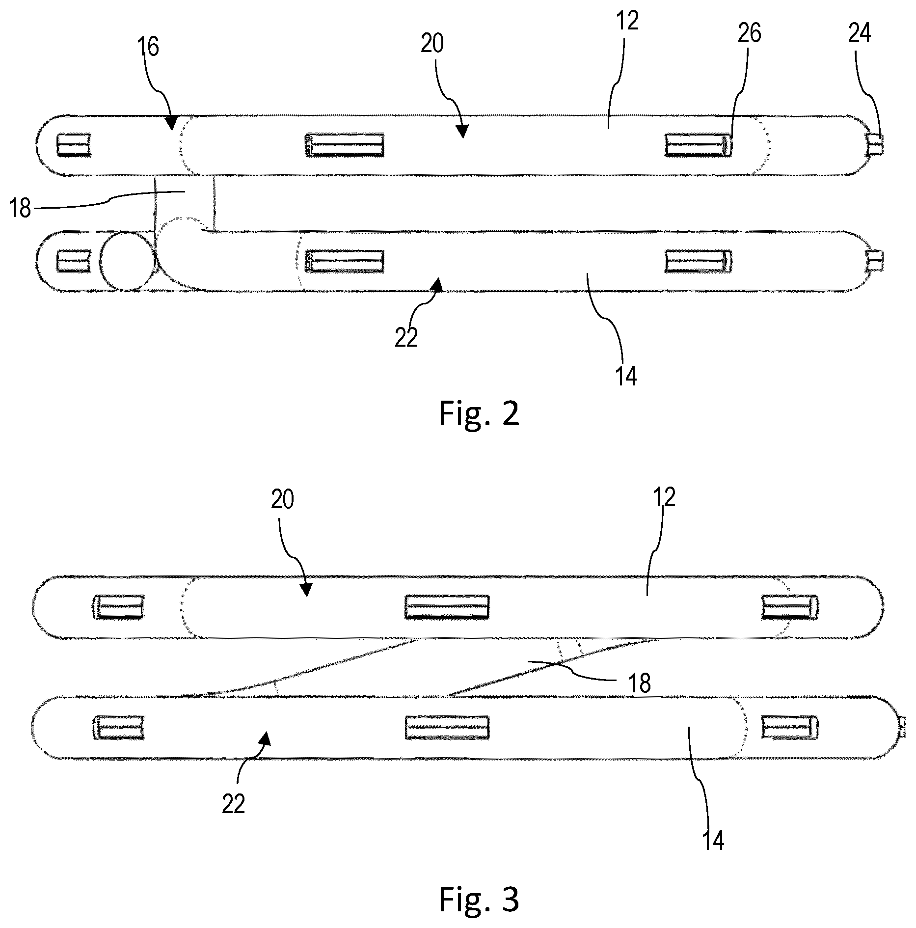 Patent US12551215 Figure 2 – Apparatus and method for forming an anastomosis
