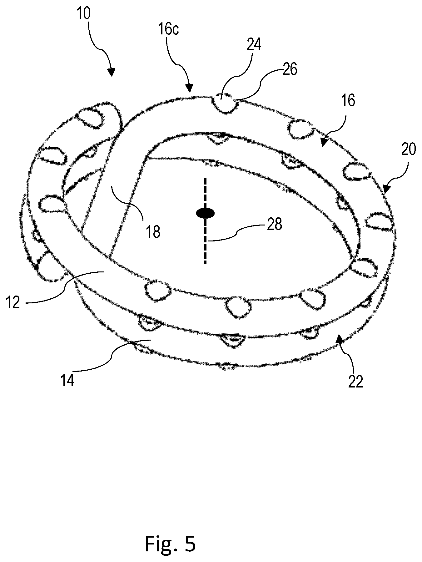 Patent US12551215 Figure 4 – Apparatus and method for forming an anastomosis
