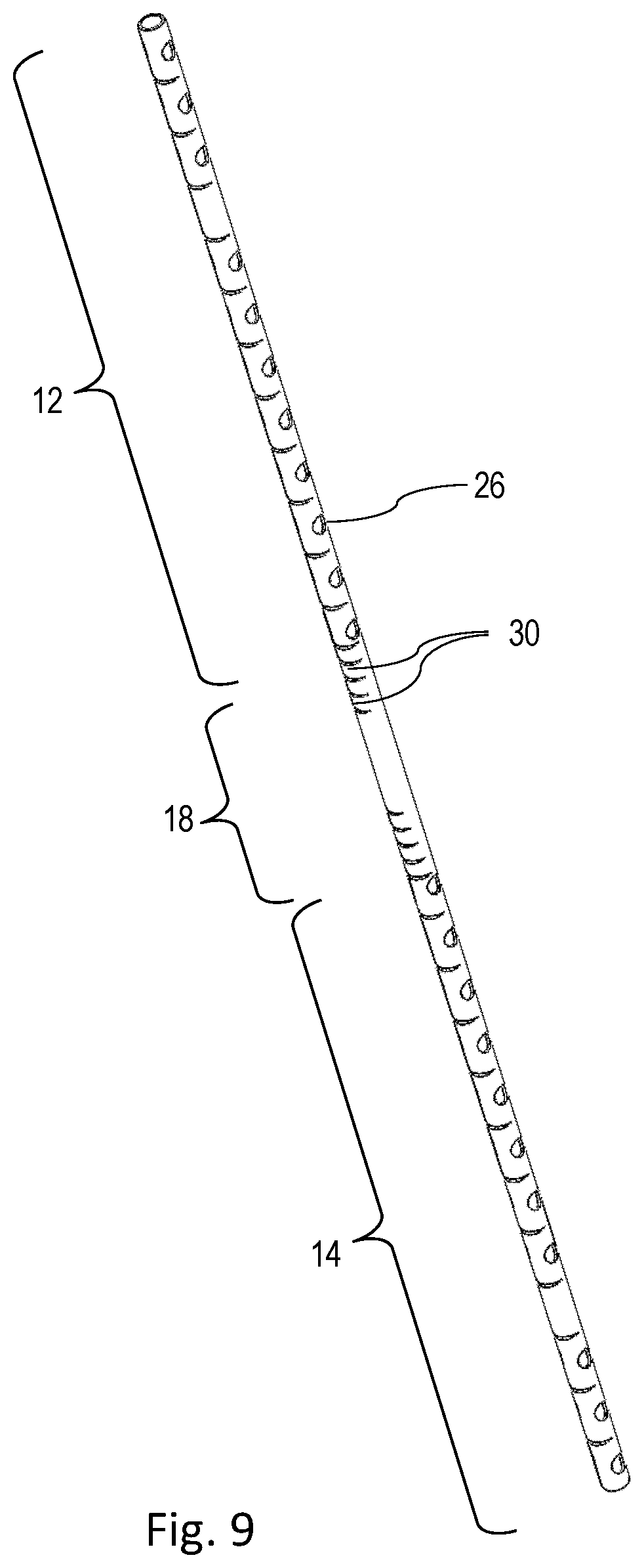 Patent US12551215 Figure 8 – Apparatus and method for forming an anastomosis