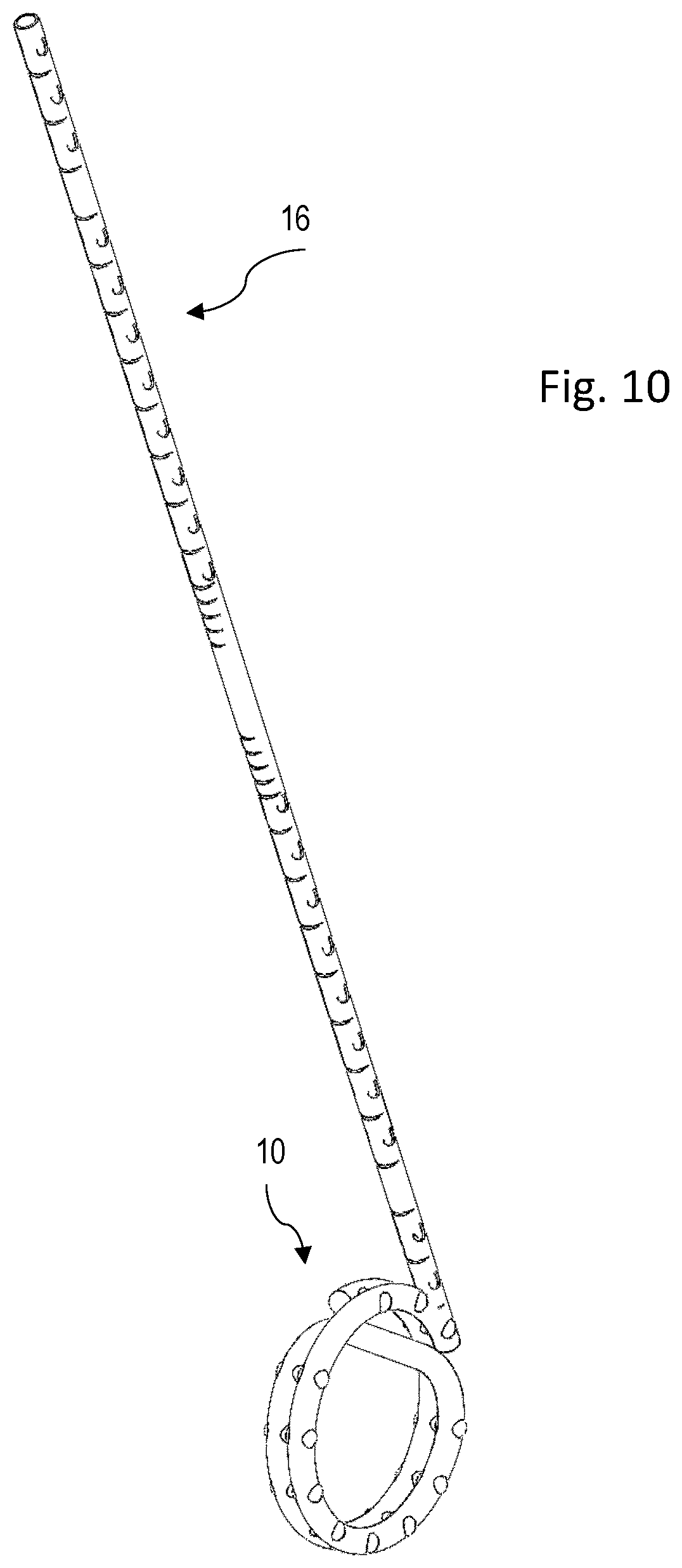 Patent US12551215 Figure 9 – Apparatus and method for forming an anastomosis