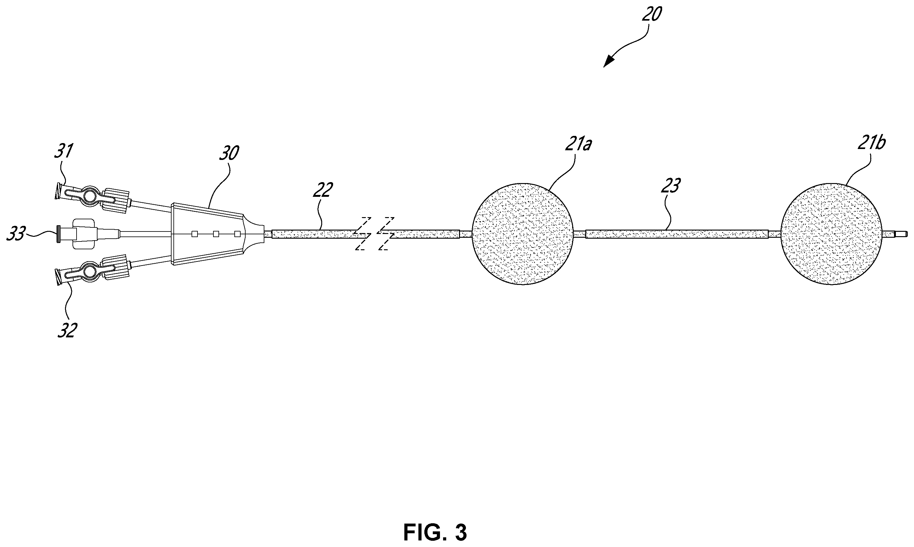 Patent US12551216 Figure 3 – Double-balloon catheter