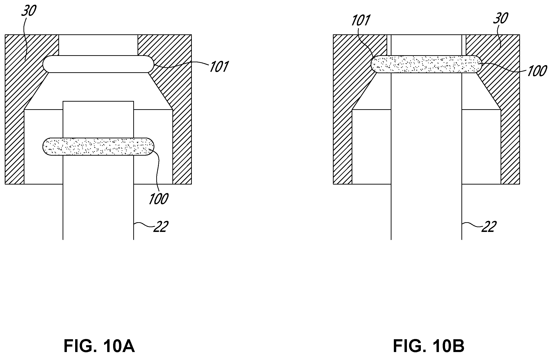 Patent US12551216 Figure 10 – Double-balloon catheter