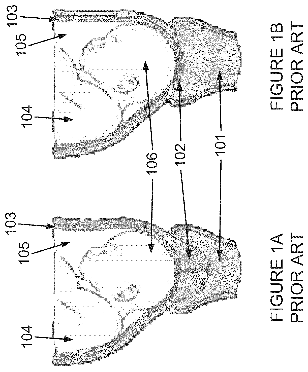 Patent US12551217 Figure 1 – Delaying pre-term birth