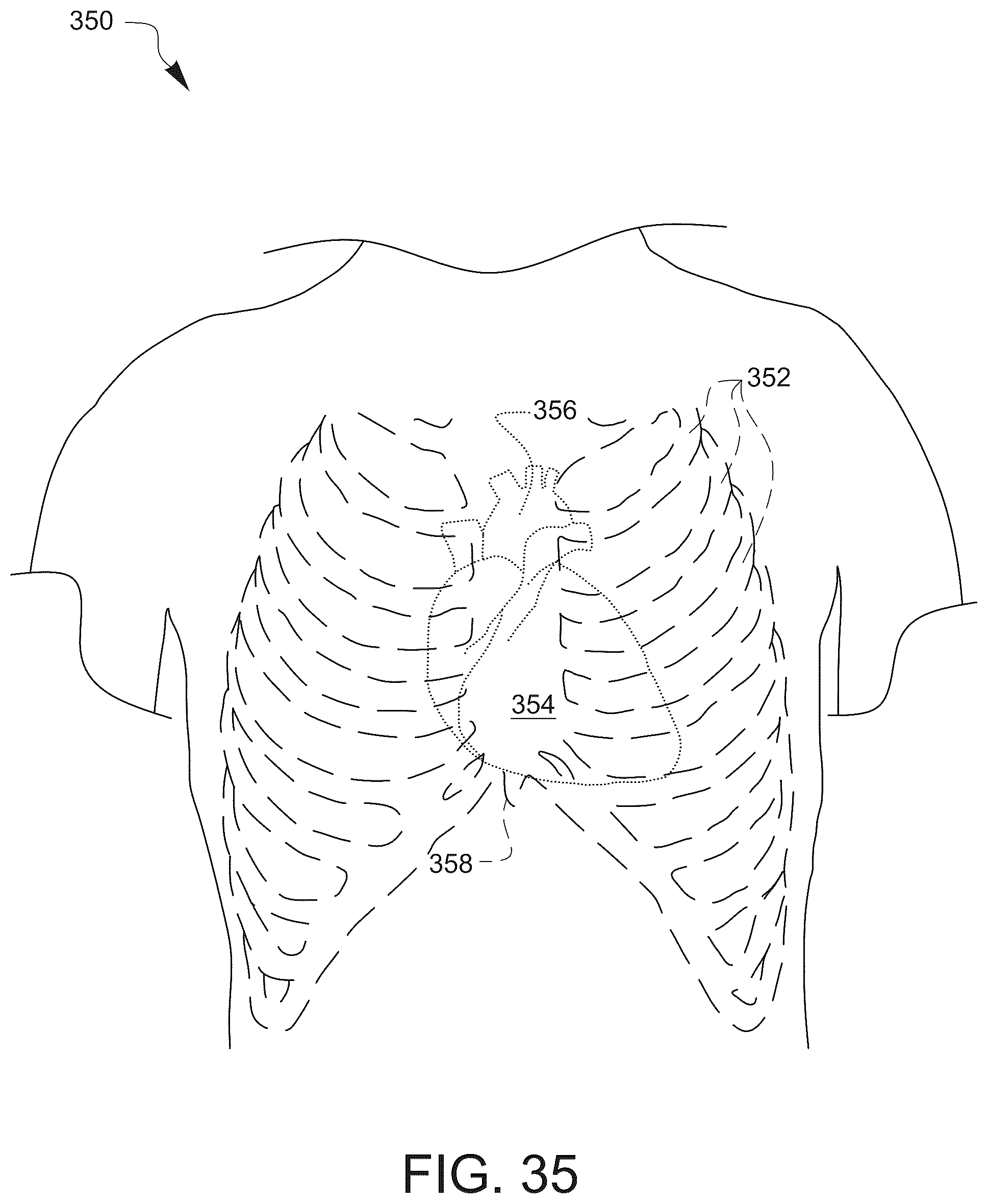 Patent US12551218 Figure 20 – Vascular clamp assembly