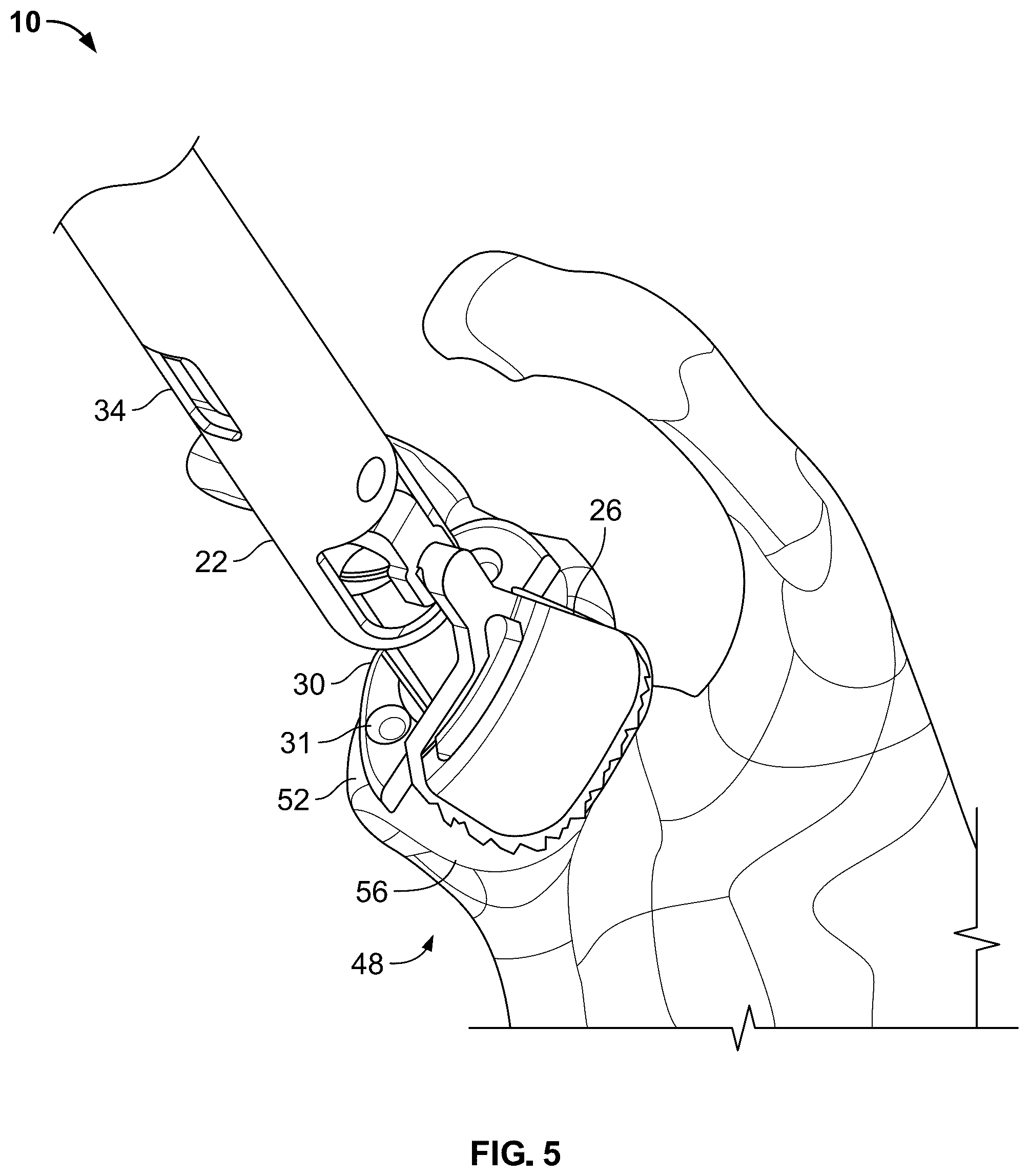 Patent US12551220 Figure 6 – Reamer for augmented glenoid implant