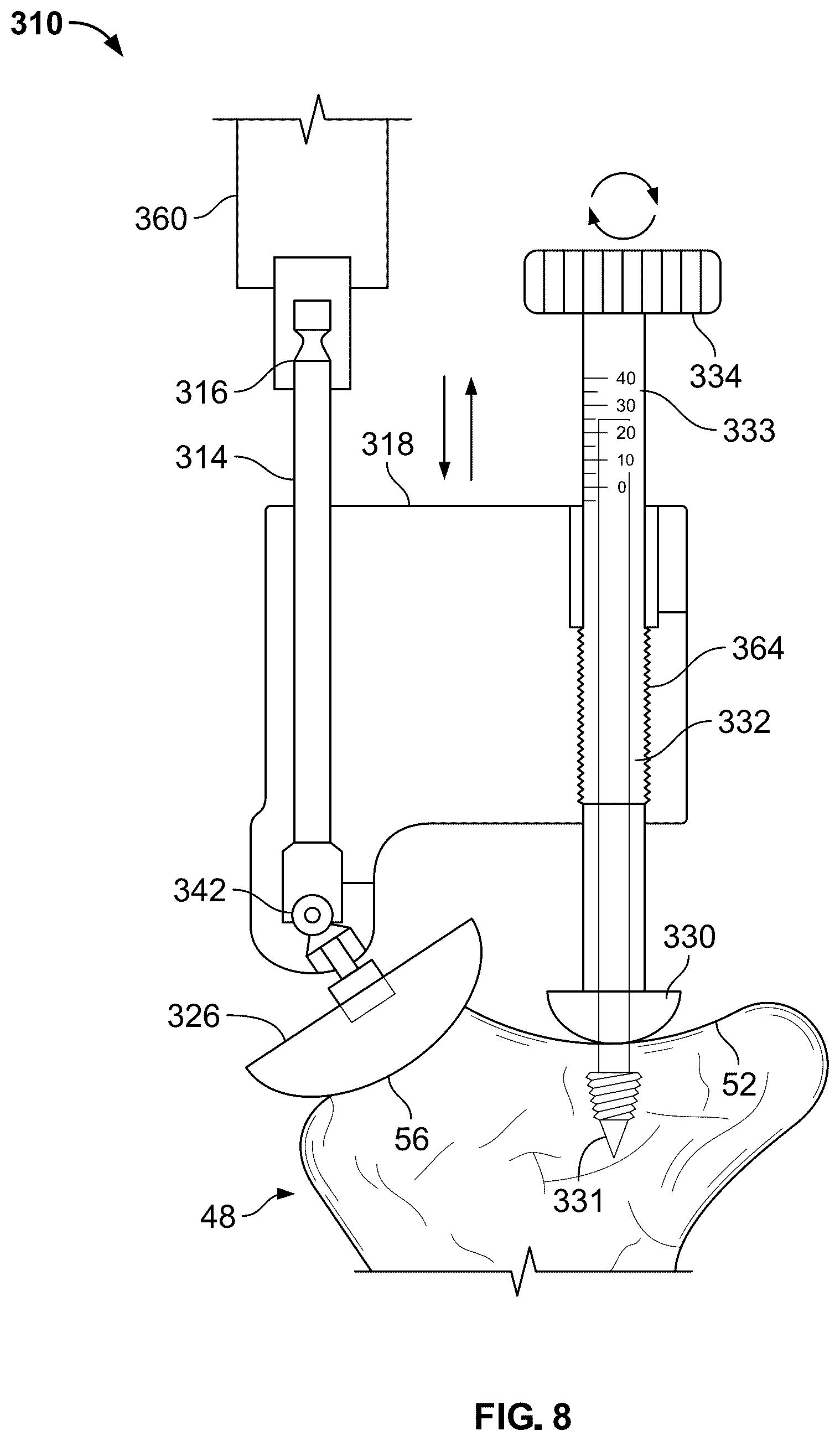 Patent US12551220 Figure 9 – Reamer for augmented glenoid implant