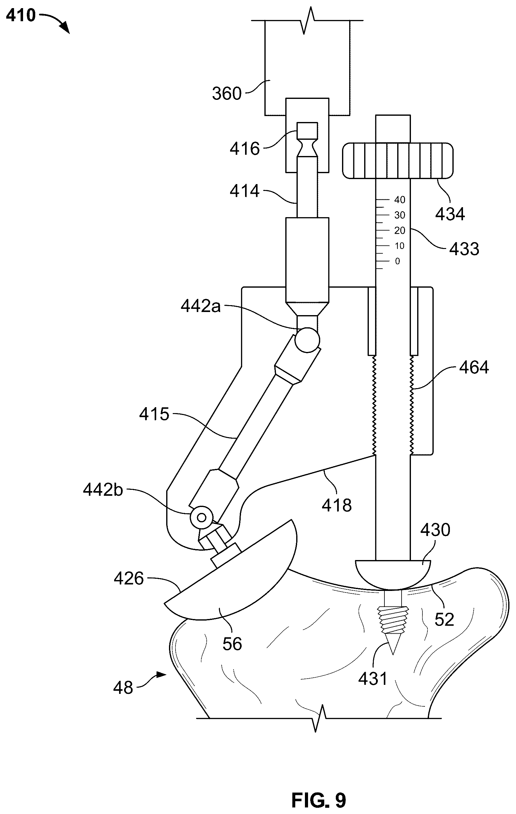 Patent US12551220 Figure 10 – Reamer for augmented glenoid implant