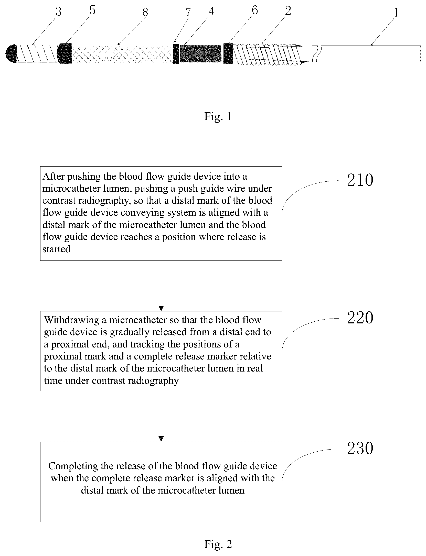 Patent US12551221 Figure 1 – Blood flow guide device conveying system capable of visual tracking and positioning, and tracking and positioning method