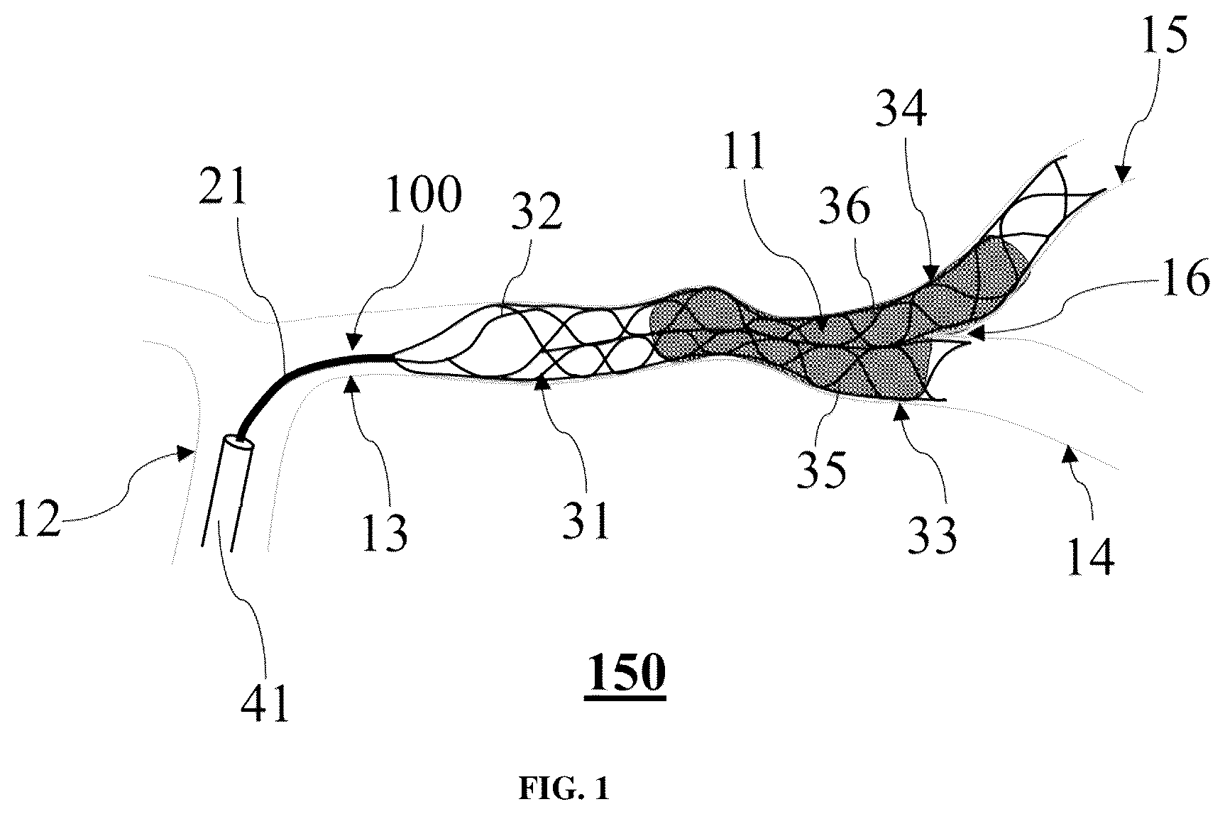 Patent US12551223 Figure 1 – Clot removal device