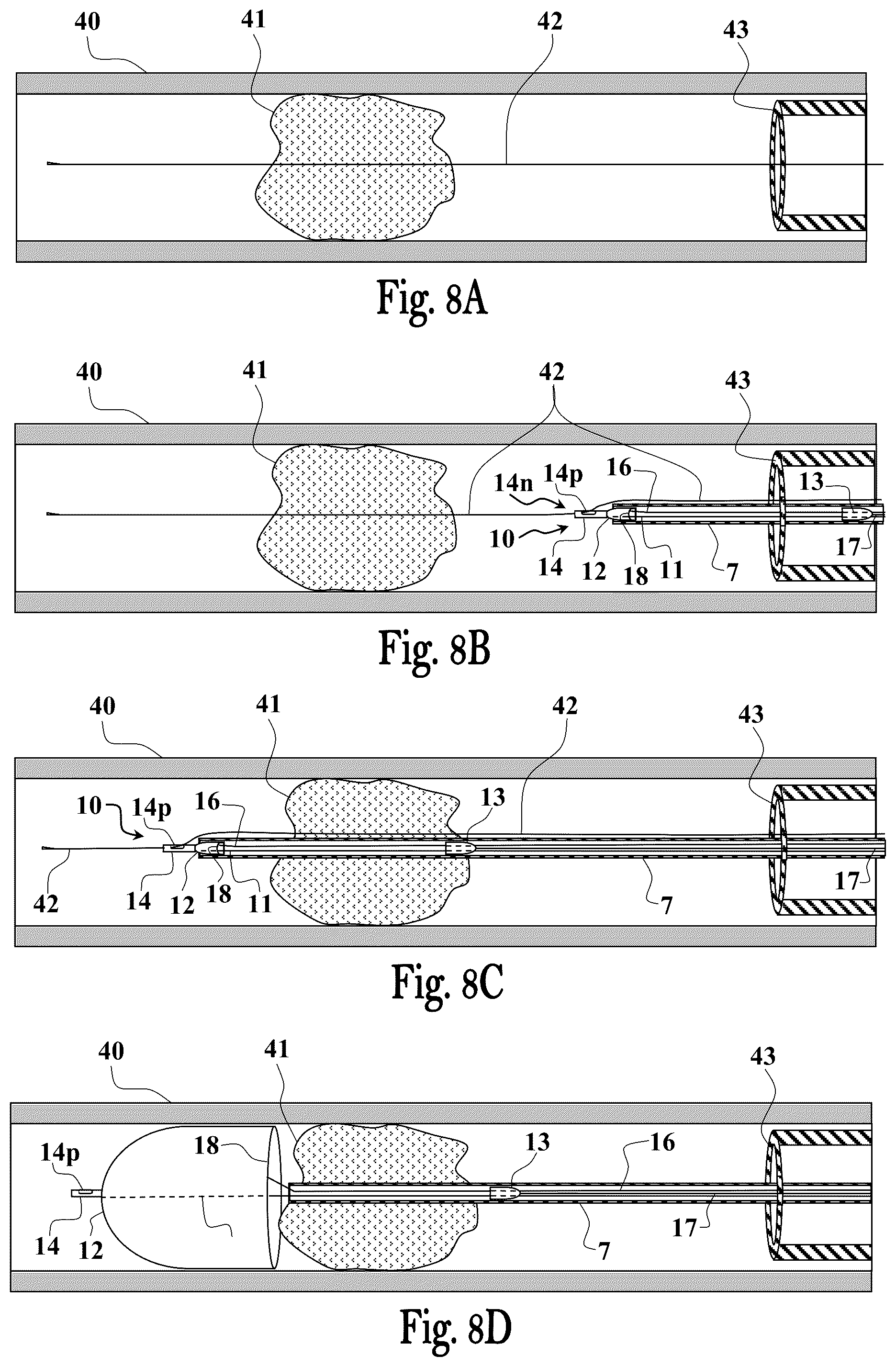 Patent US12551224 Figure 7 – Clot removal device and method