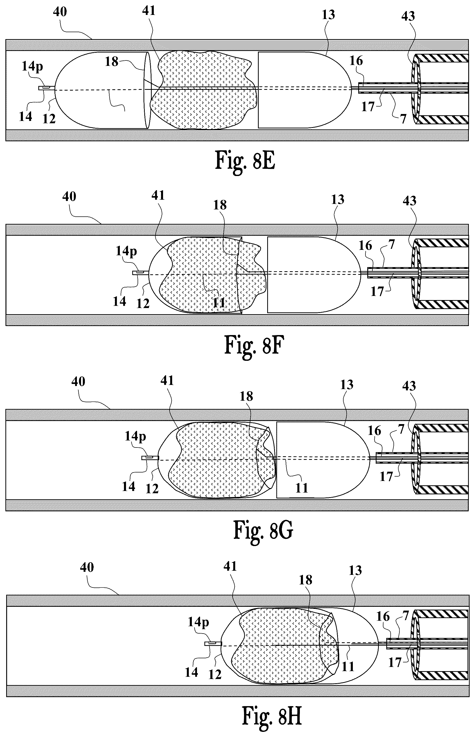 Patent US12551224 Figure 8 – Clot removal device and method