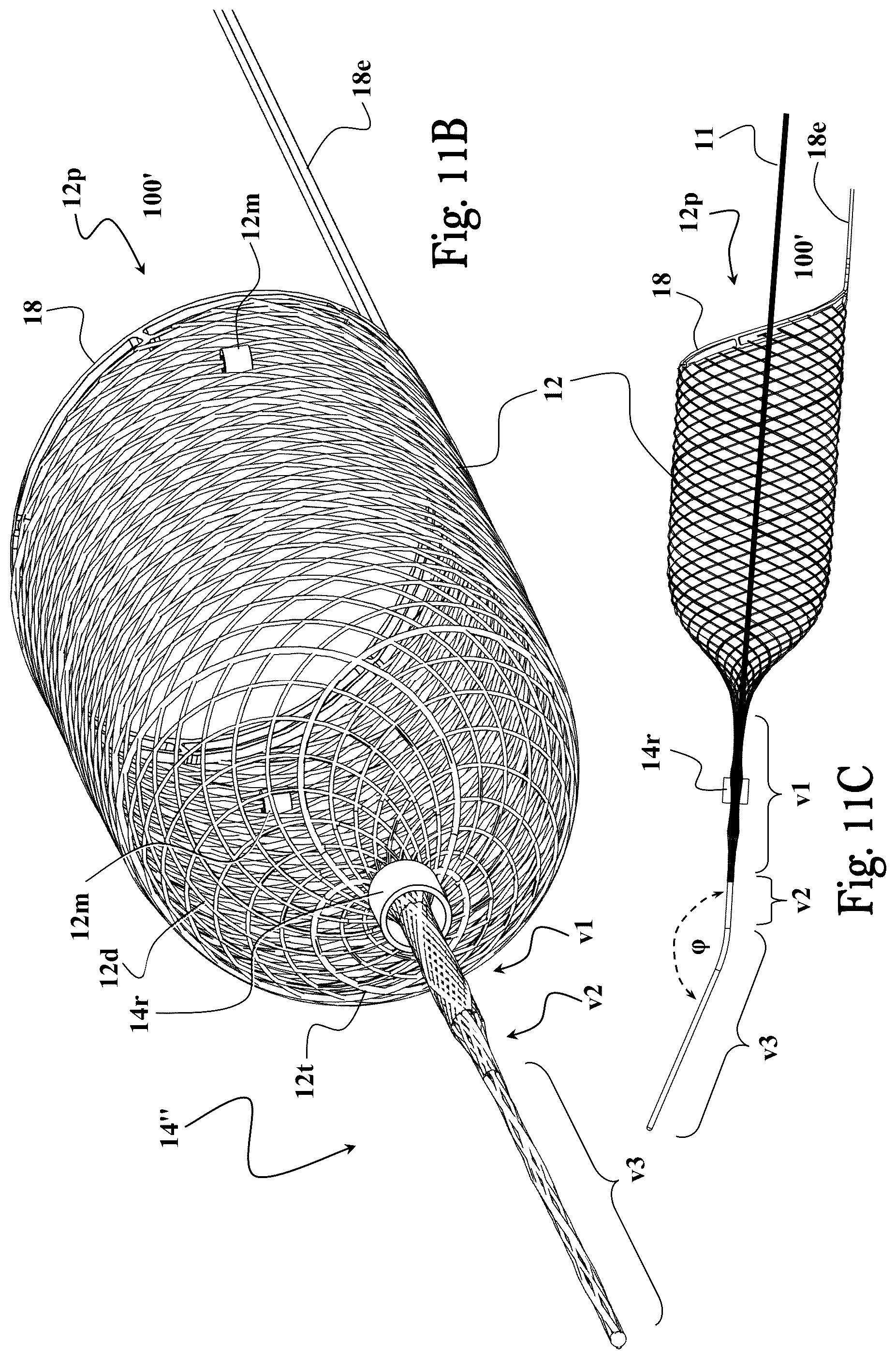 Patent US12551224 Figure 12 – Clot removal device and method