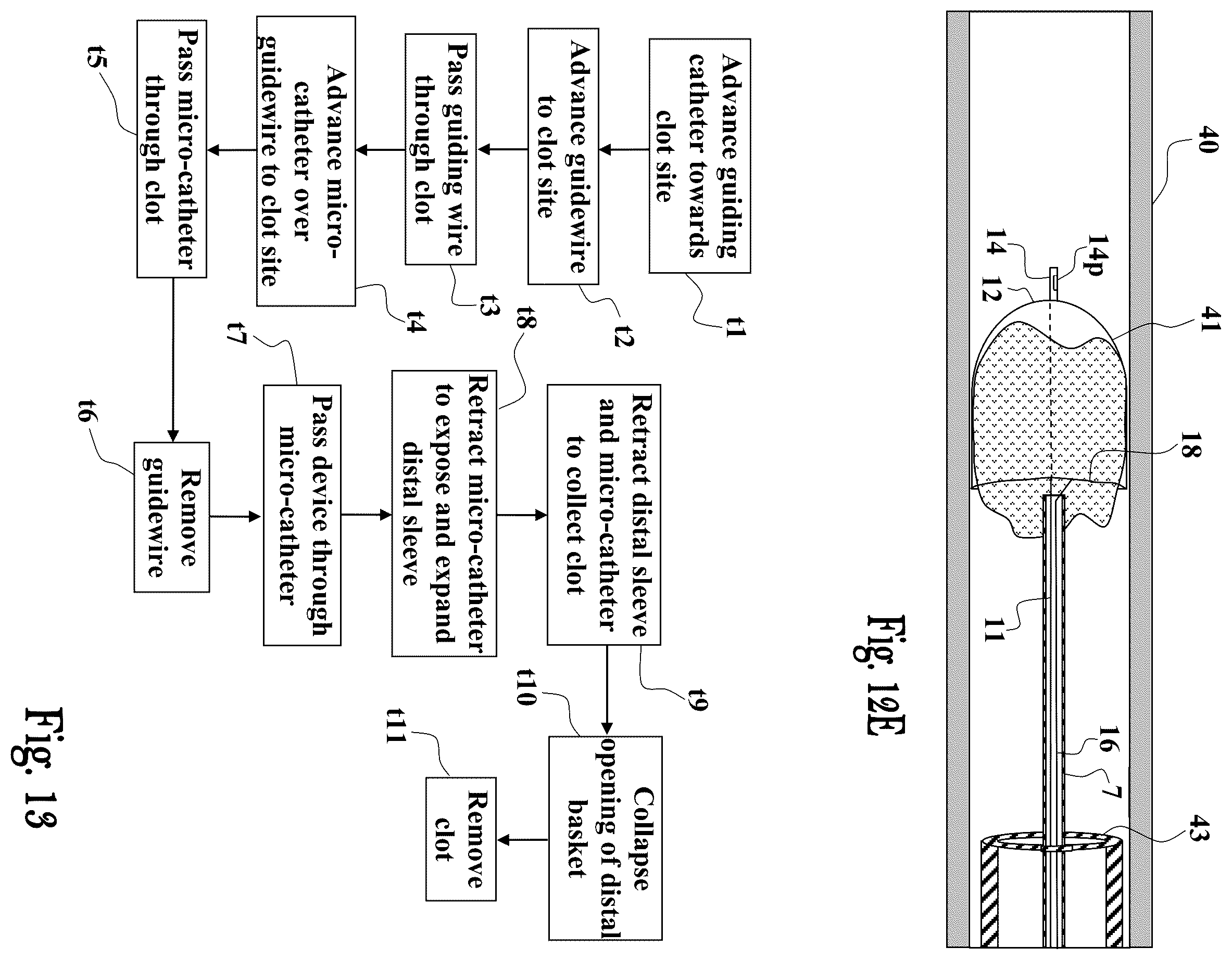 Patent US12551224 Figure 14 – Clot removal device and method