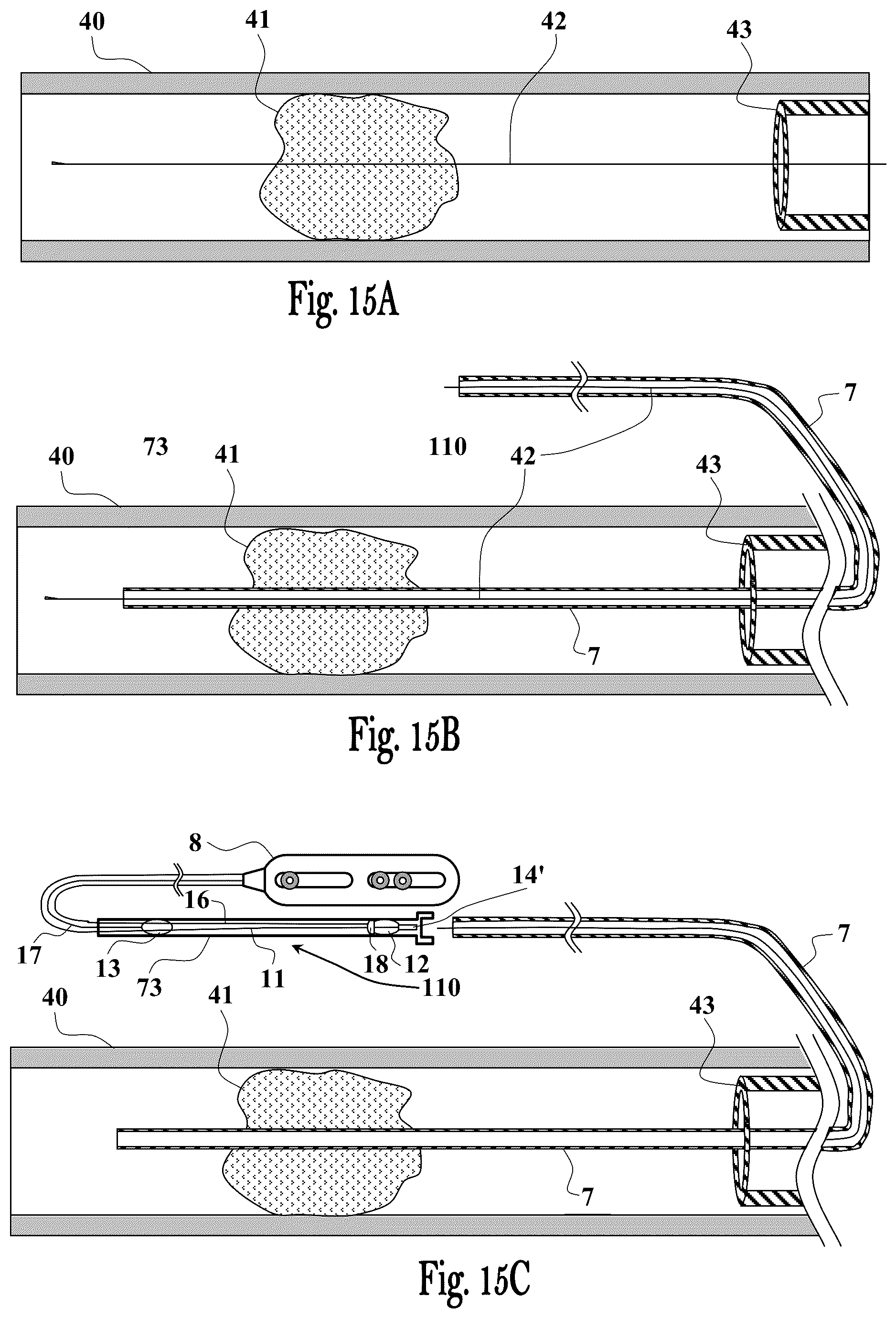 Patent US12551224 Figure 16 – Clot removal device and method