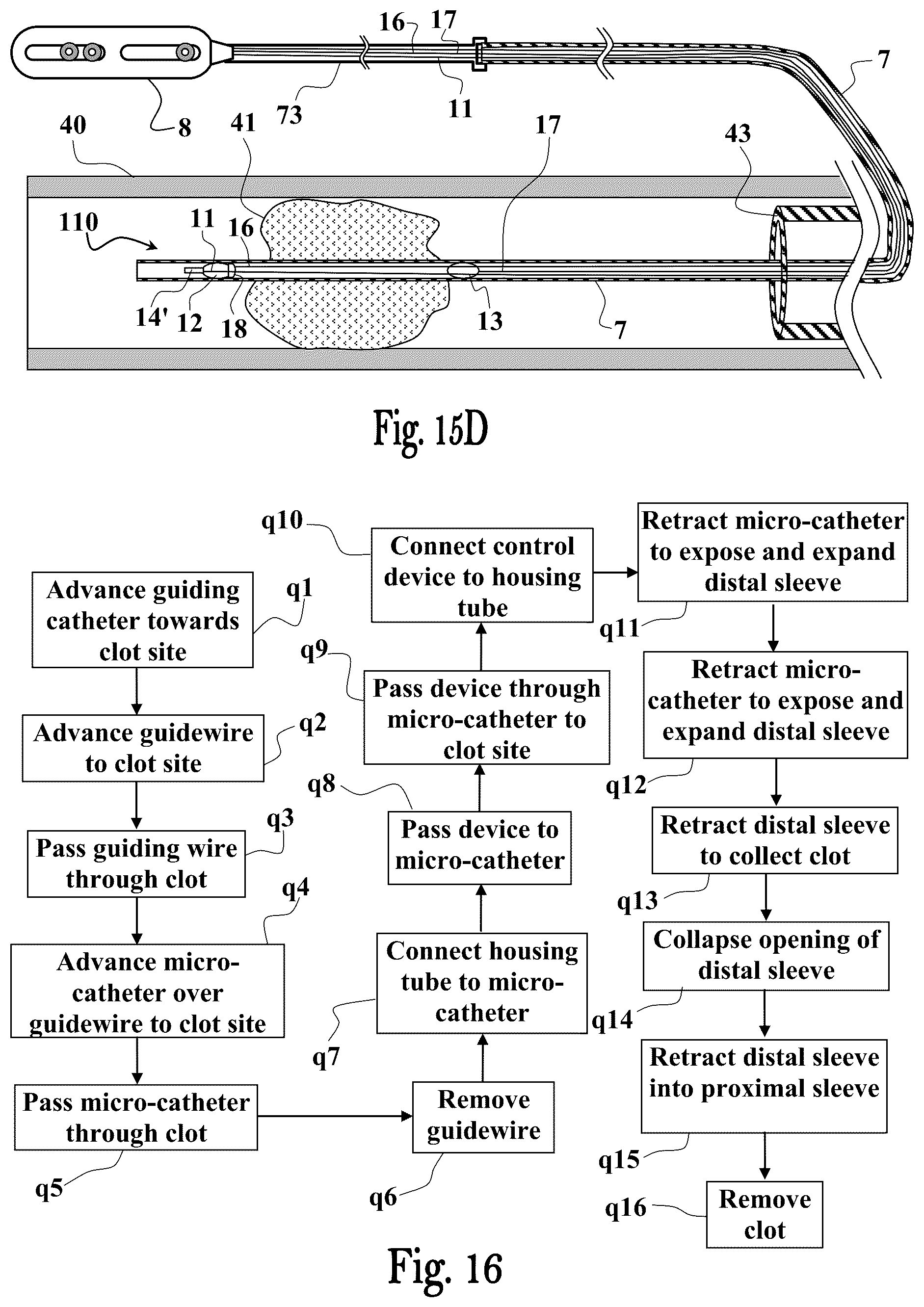 Patent US12551224 Figure 17 – Clot removal device and method