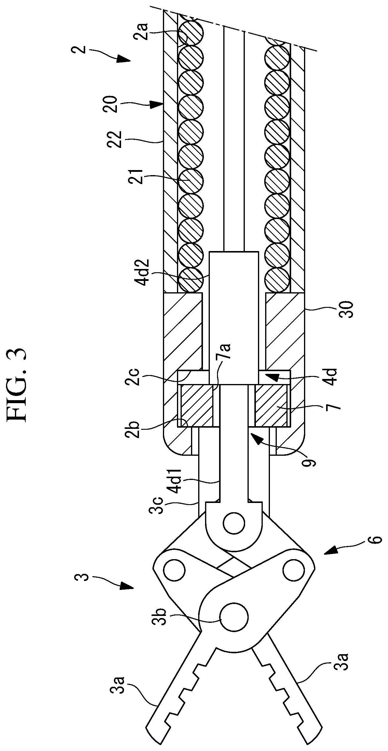 Patent US12551226 Figure 3 – Endoscopic surgical device