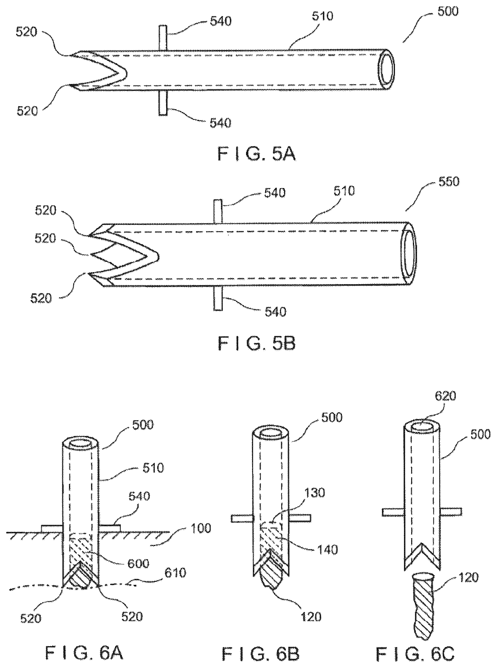 Patent US12551232 Figure 3 – Method and apparatus for tissue grafting and copying