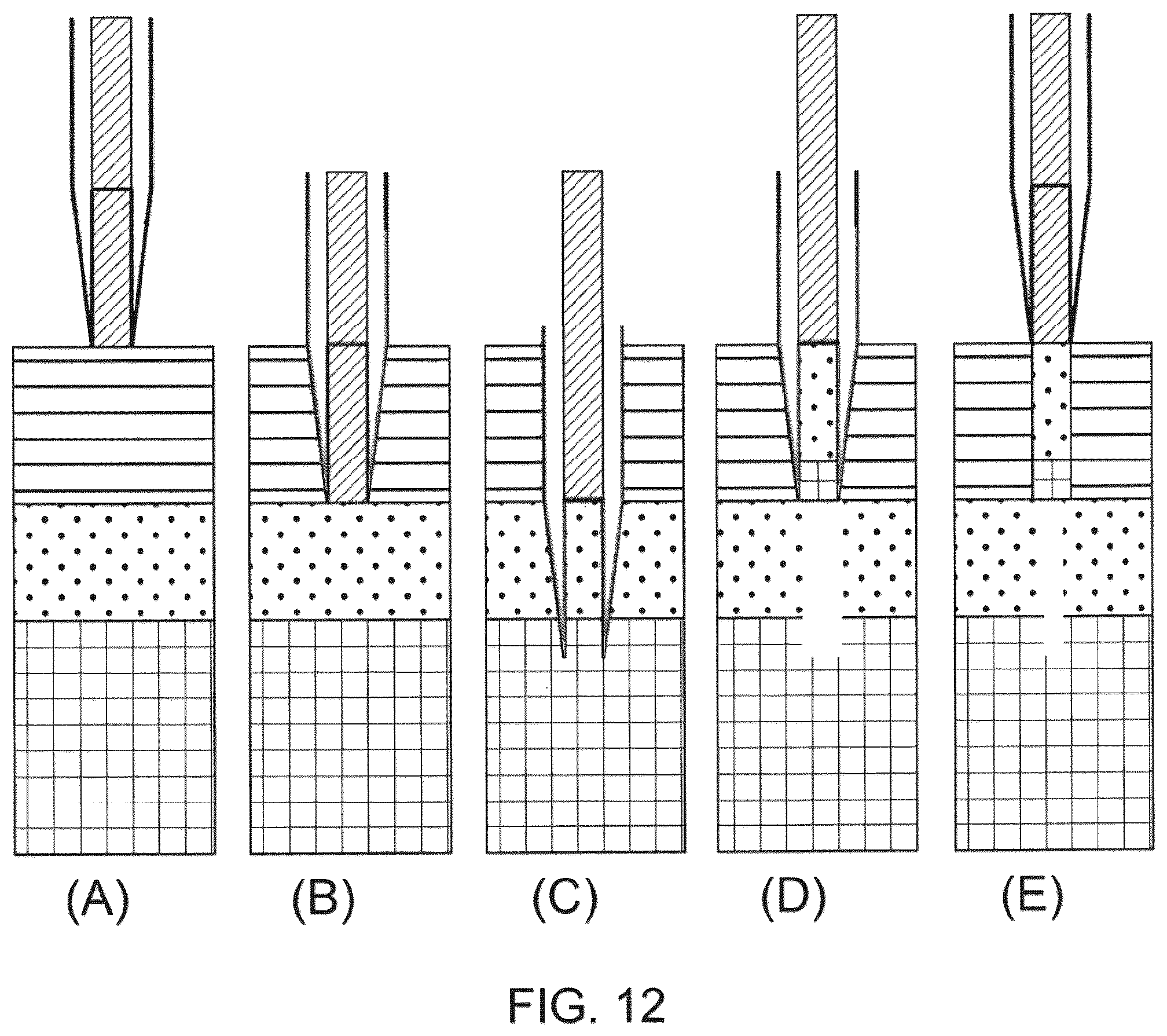 Patent US12551232 Figure 10 – Method and apparatus for tissue grafting and copying