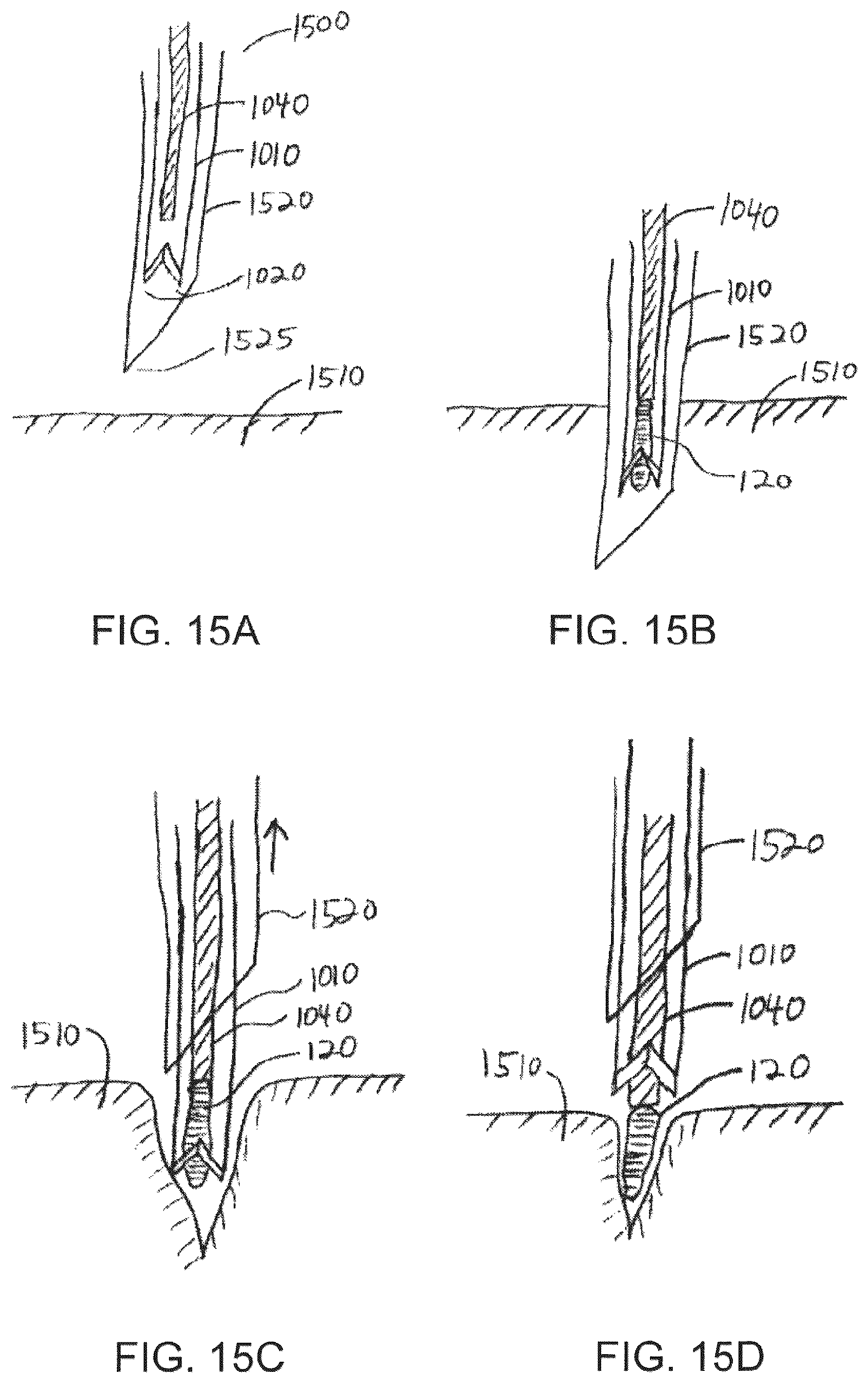 Patent US12551232 Figure 12 – Method and apparatus for tissue grafting and copying