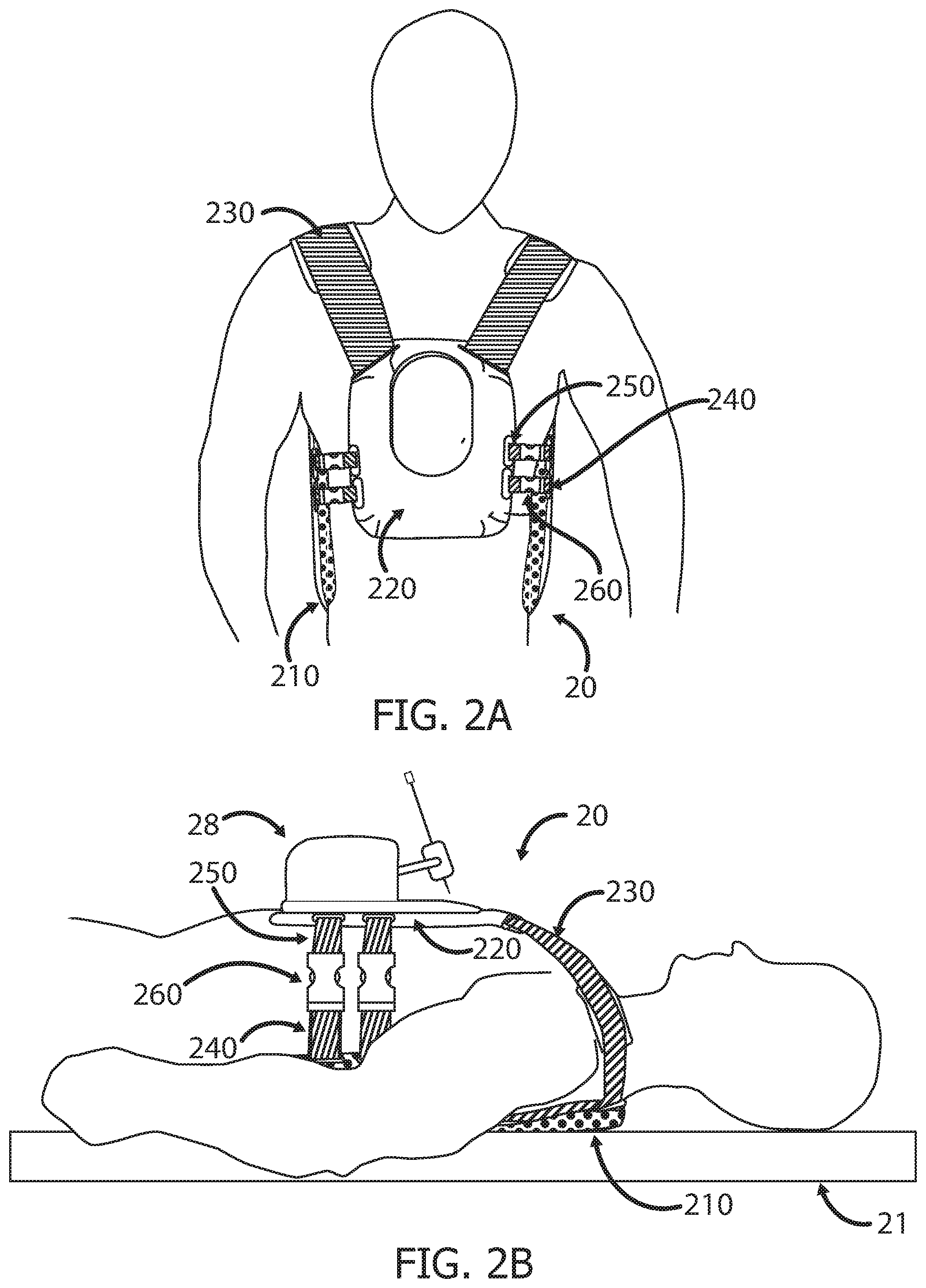 Patent US12551233 Figure 2 – Devices and methods for attaching a medical device to a subject