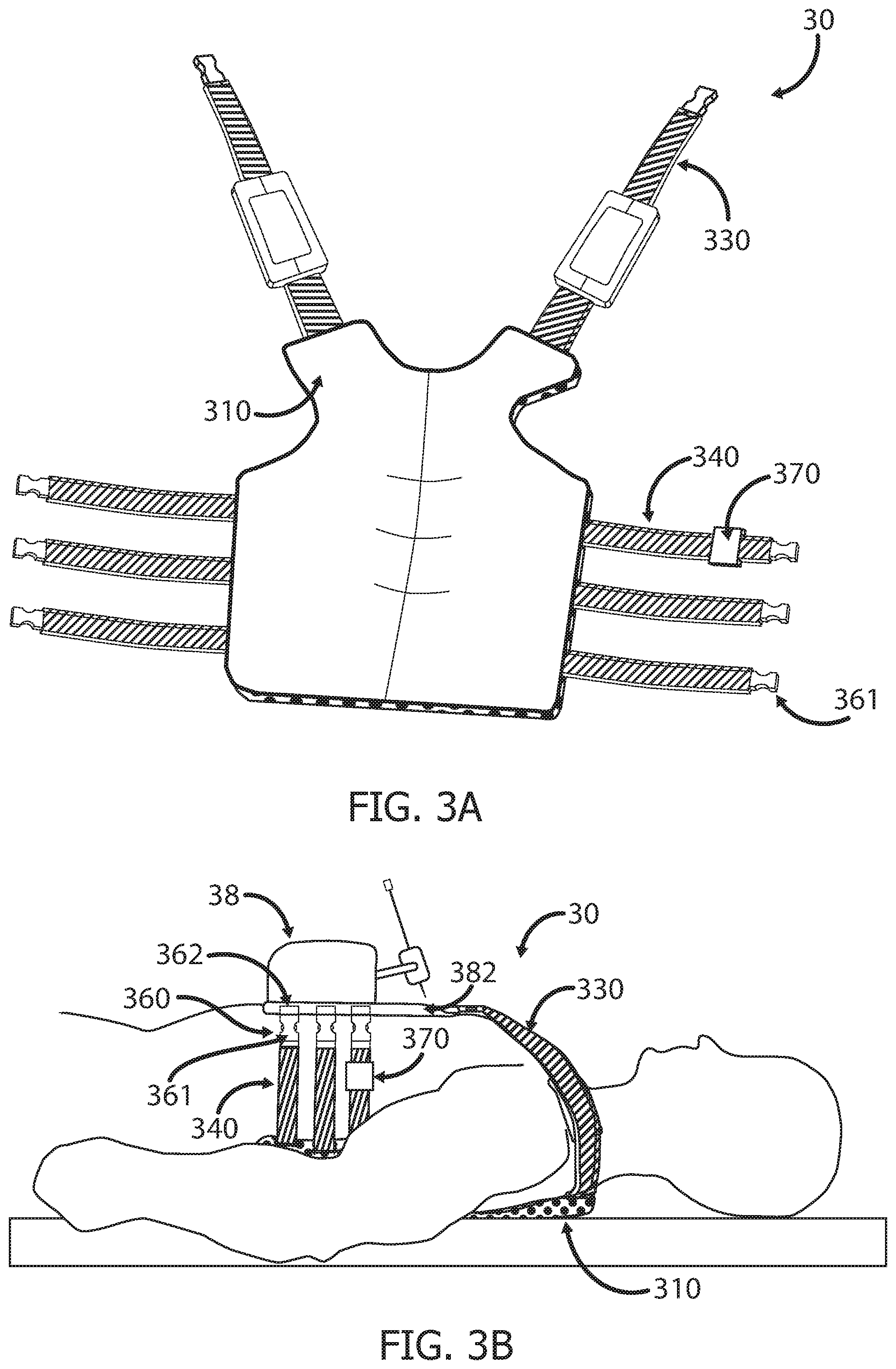 Patent US12551233 Figure 3 – Devices and methods for attaching a medical device to a subject
