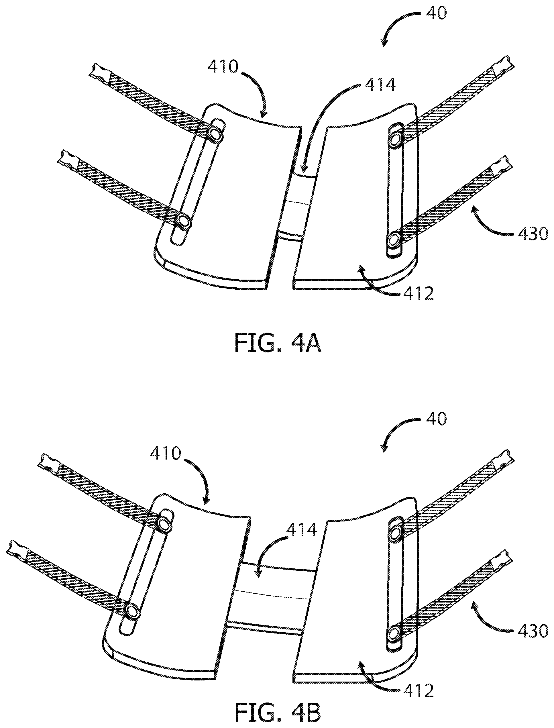 Patent US12551233 Figure 4 – Devices and methods for attaching a medical device to a subject
